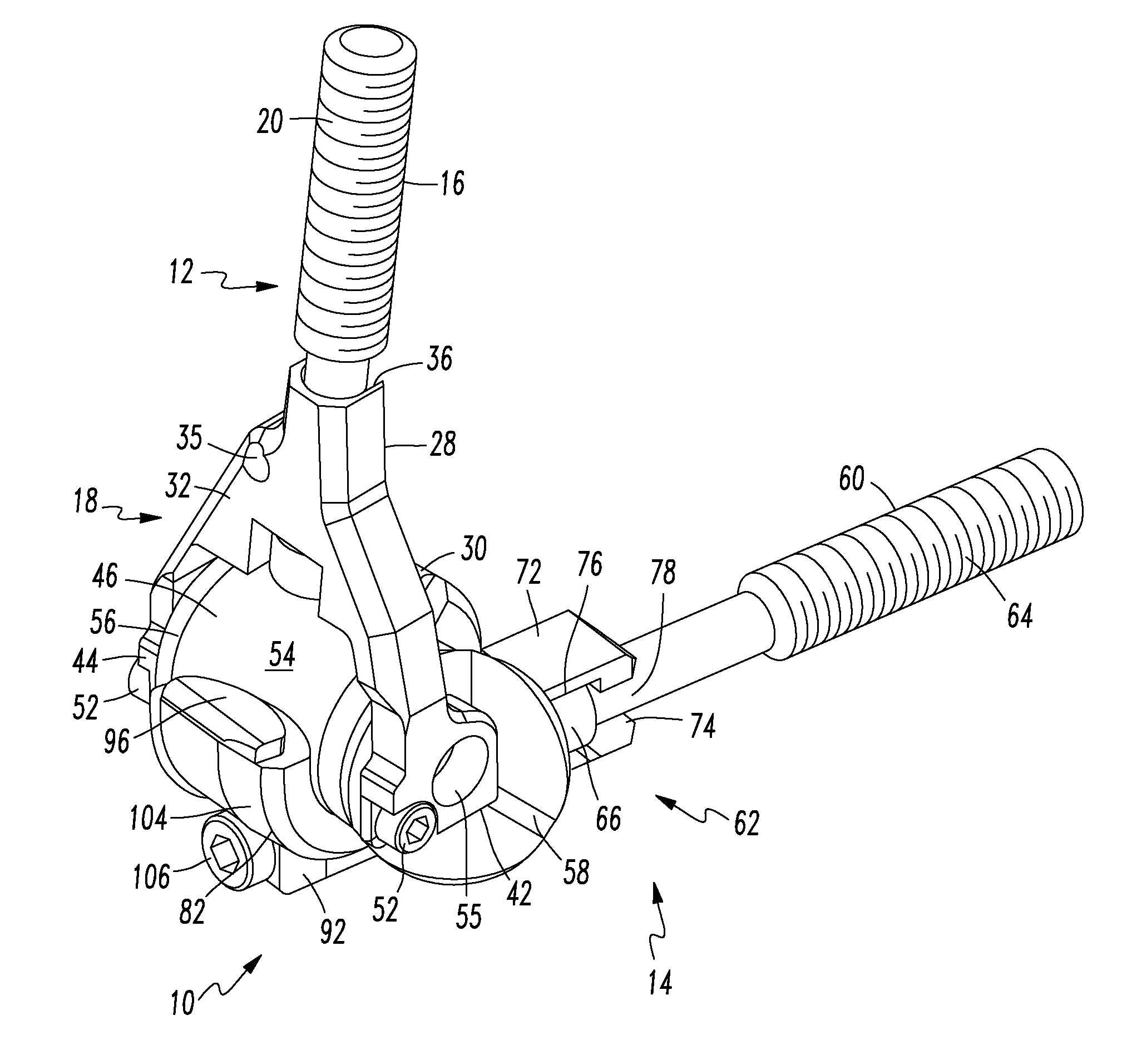 Prosthesis for partial and total joint replacement