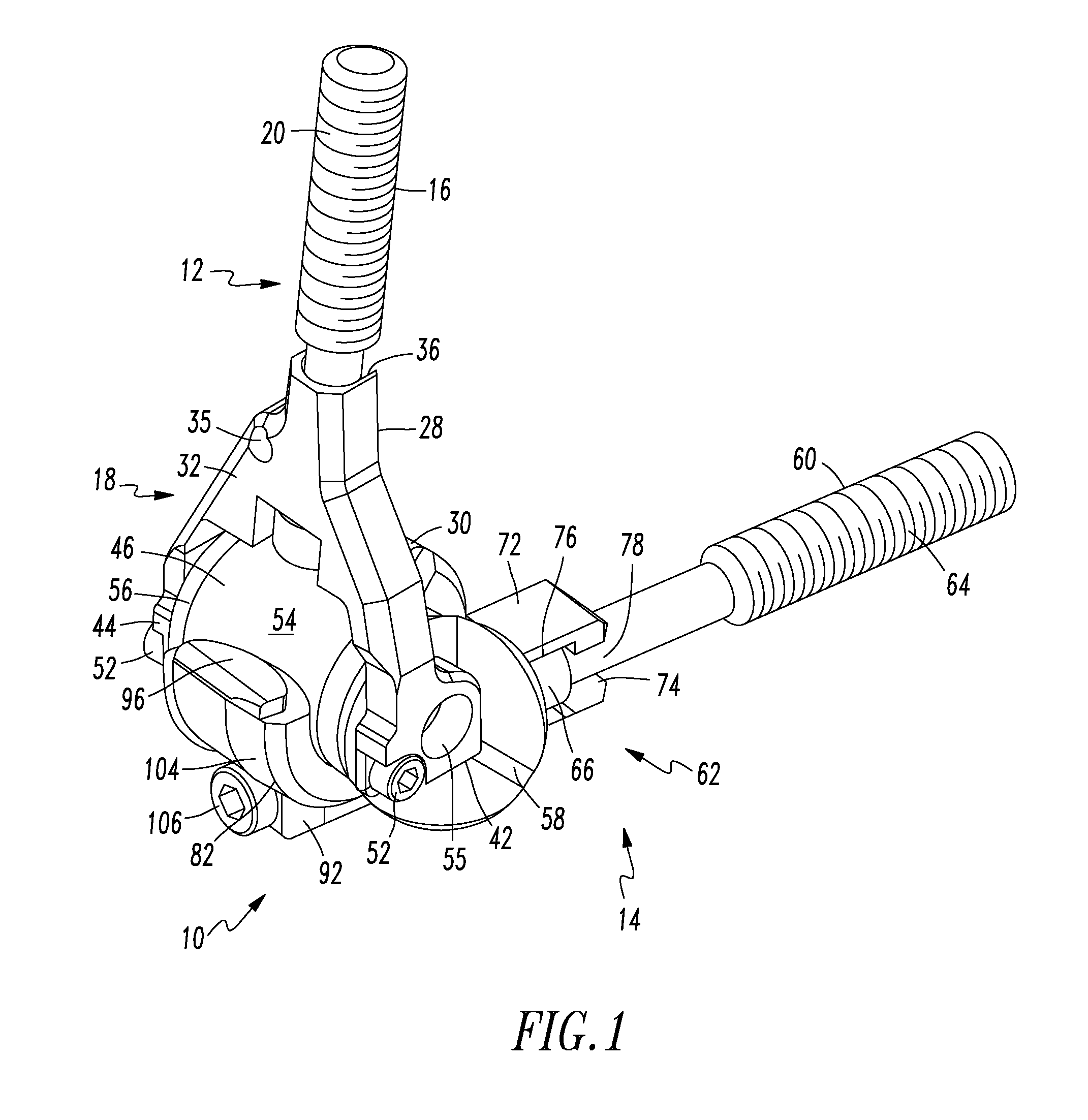 Prosthesis for partial and total joint replacement