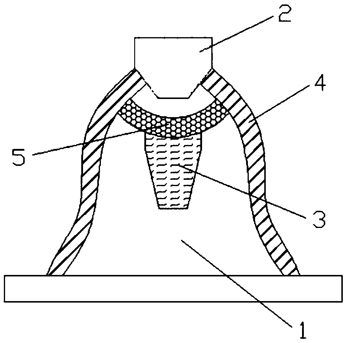 Closure device for avoiding marginal bone loss around dental implant