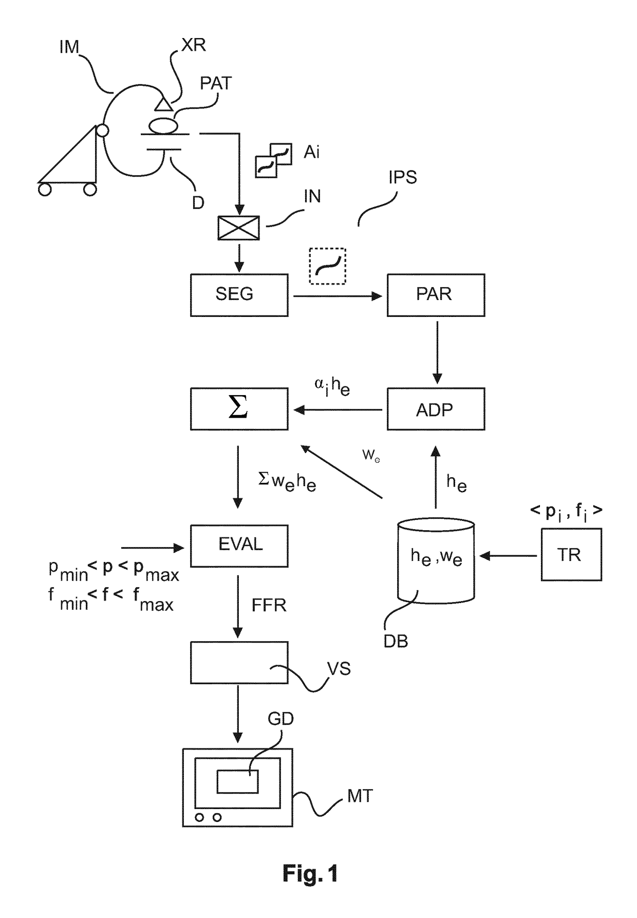 Local FFR estimation and visualisation for improved functional stenosis analysis