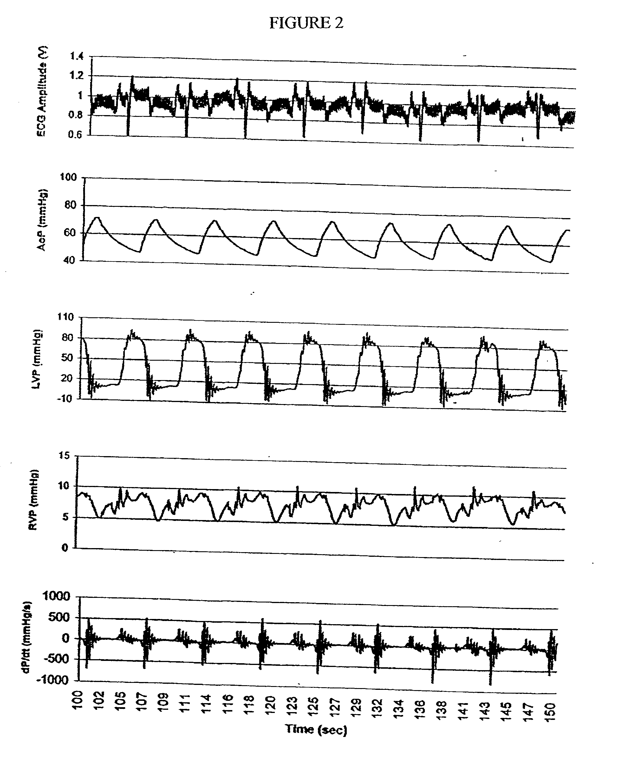 Compositions of stable T3 and methodes of use thereof