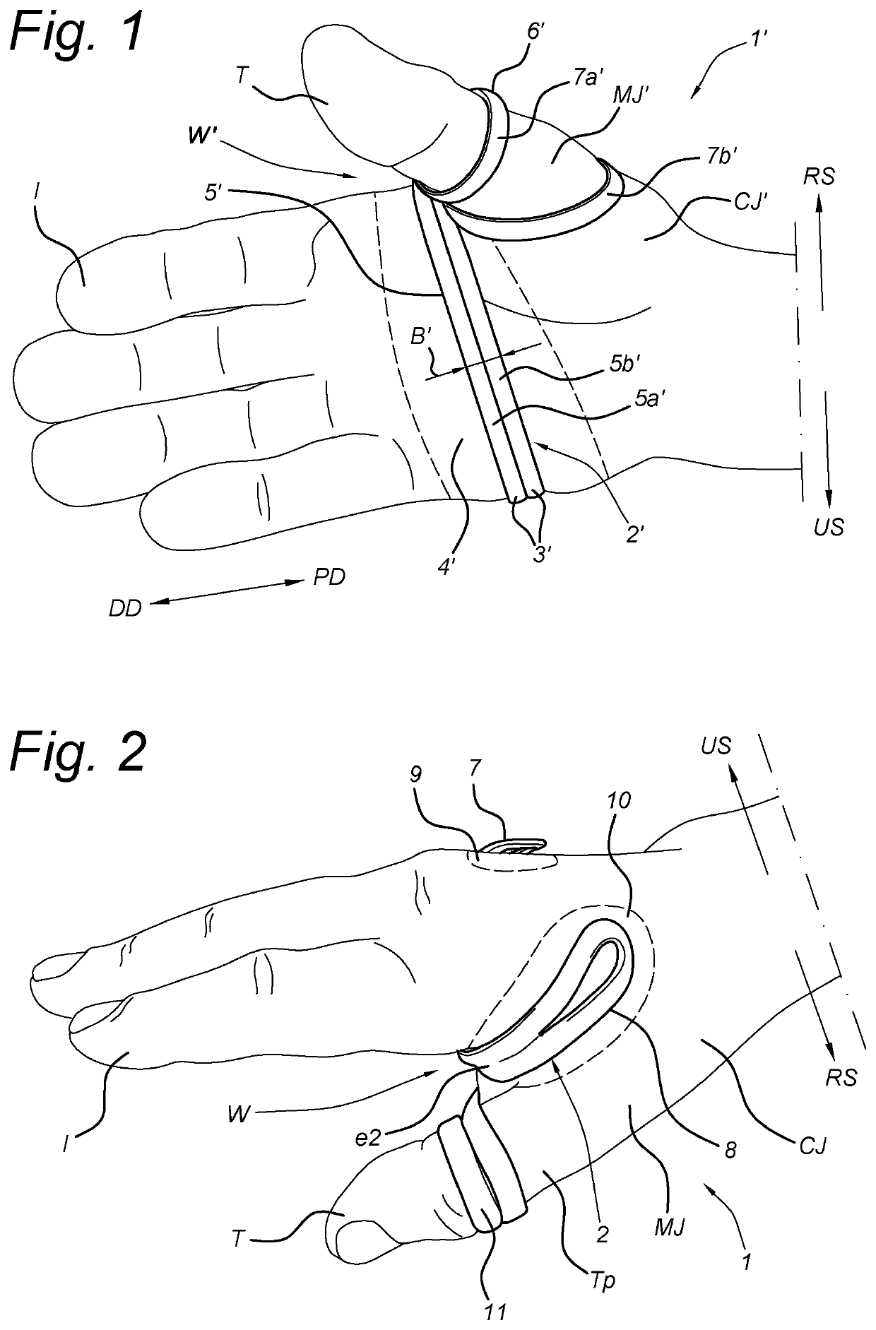 Thumb Brace