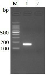 Real-time fluorescent RT-PCR detection method for MARV (Marburg virus)