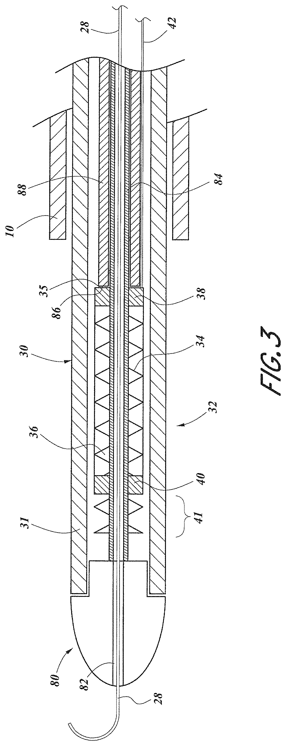 Embolic filter with controlled aperture size distribution