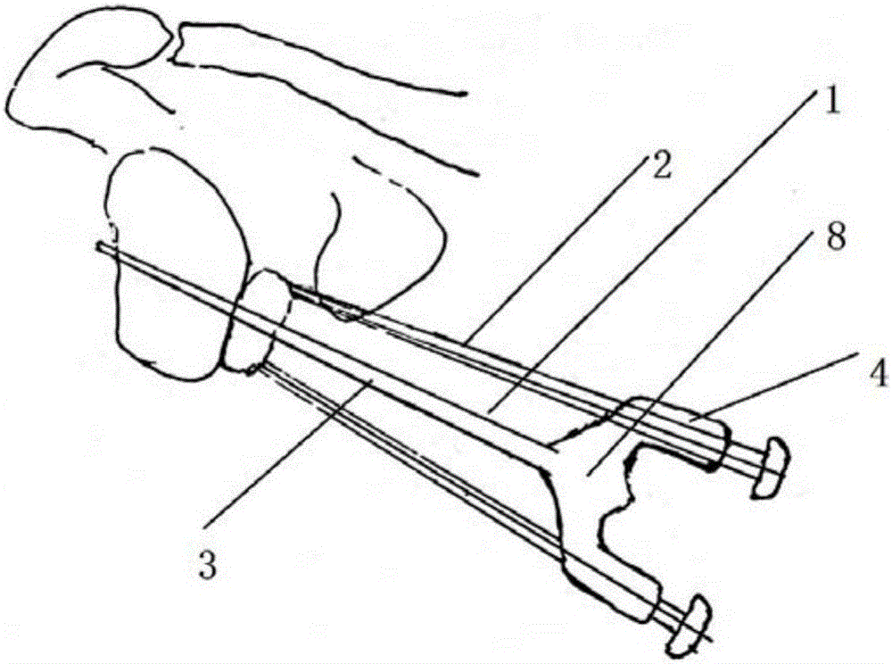 Surgery binocular locator