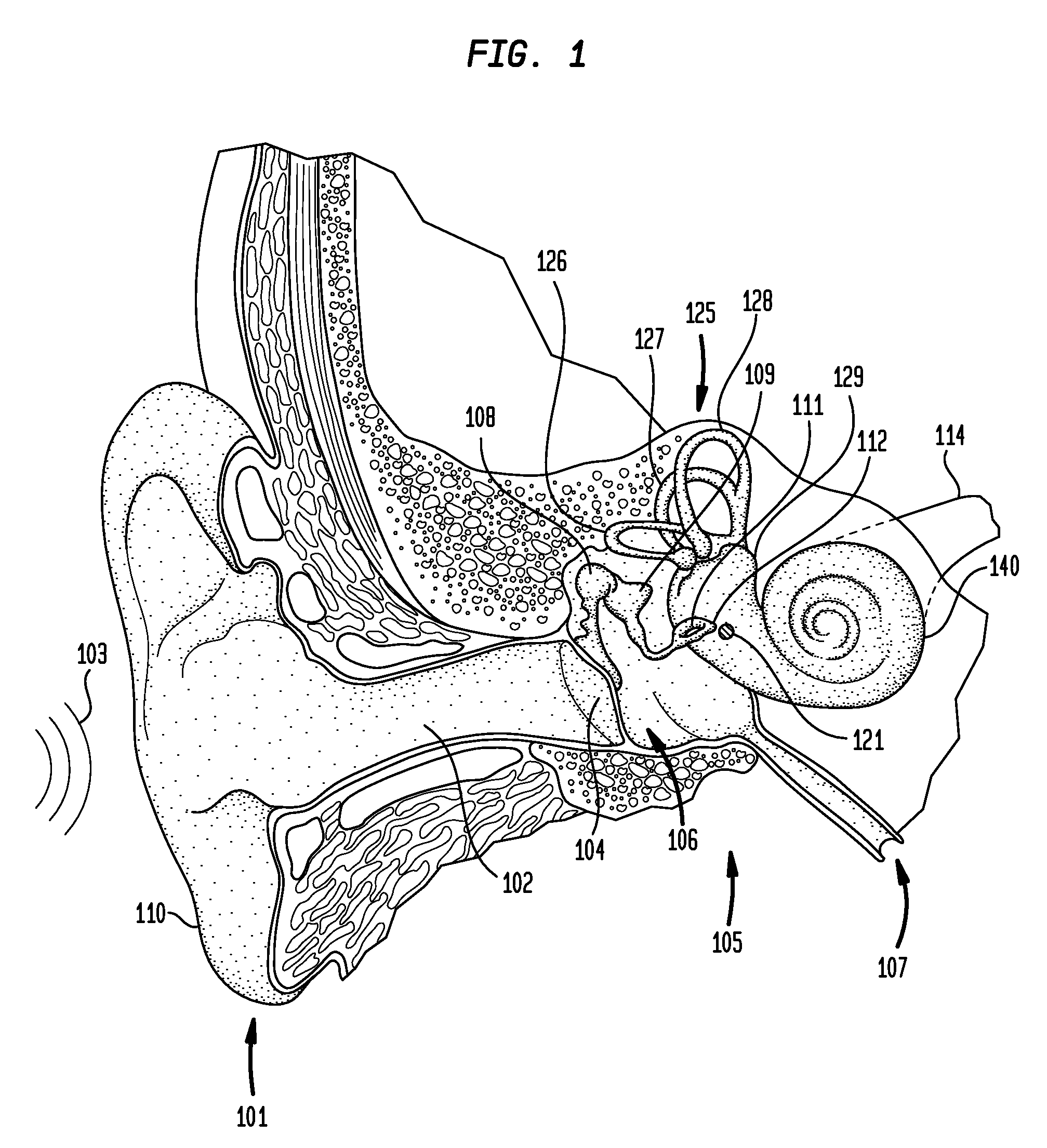 Combined functional component and implantable actuator positioning mechanism