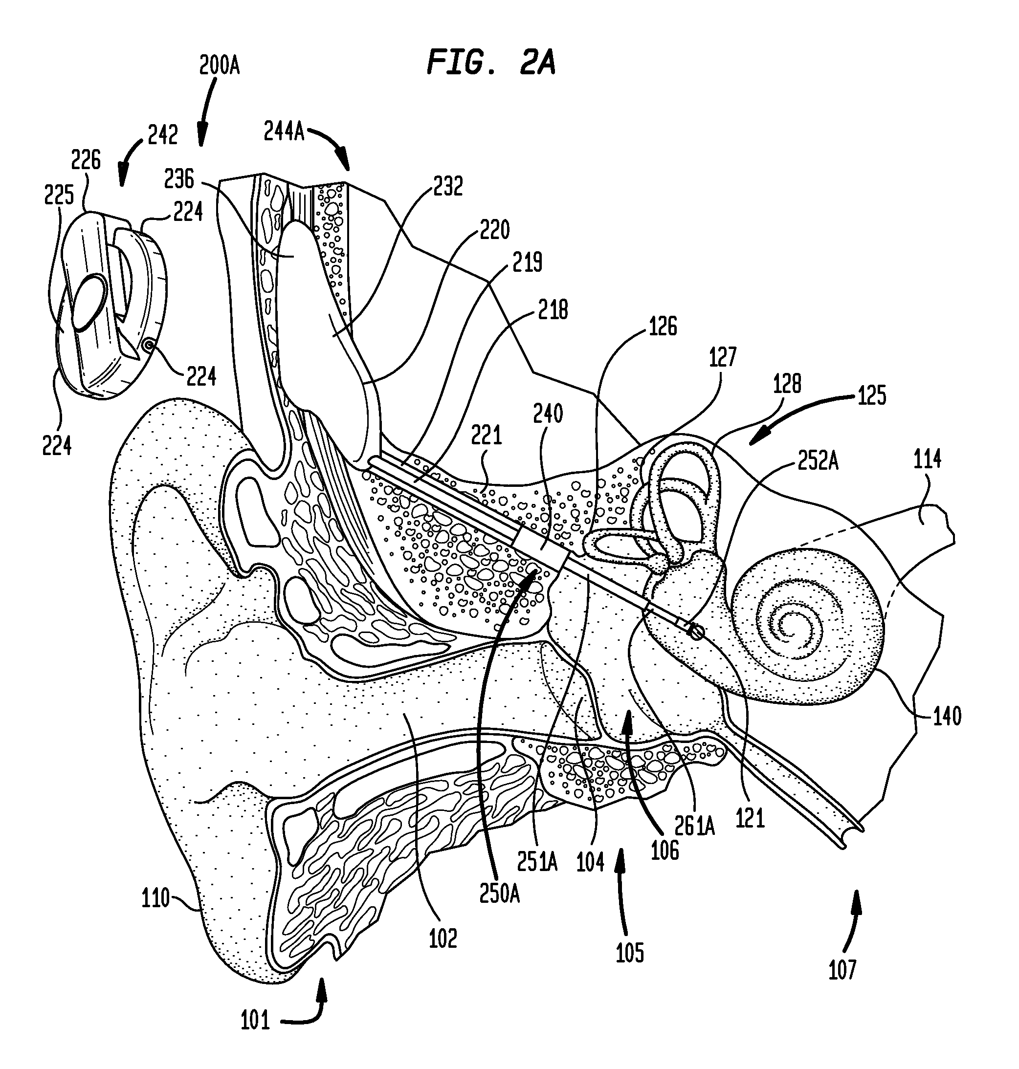 Combined functional component and implantable actuator positioning mechanism