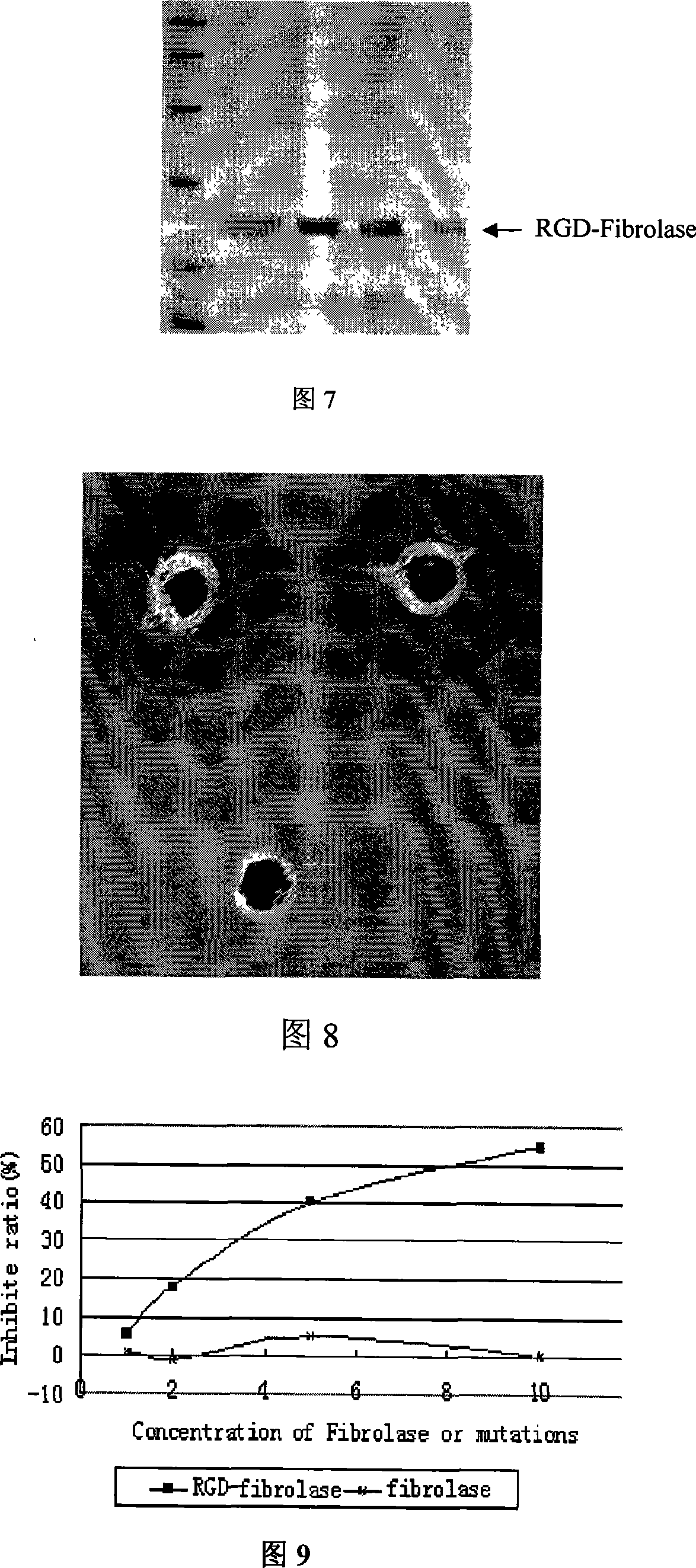 Double-functional molecule for dissolving thrombus and inhibiting blood platelet aggregate and use thereof