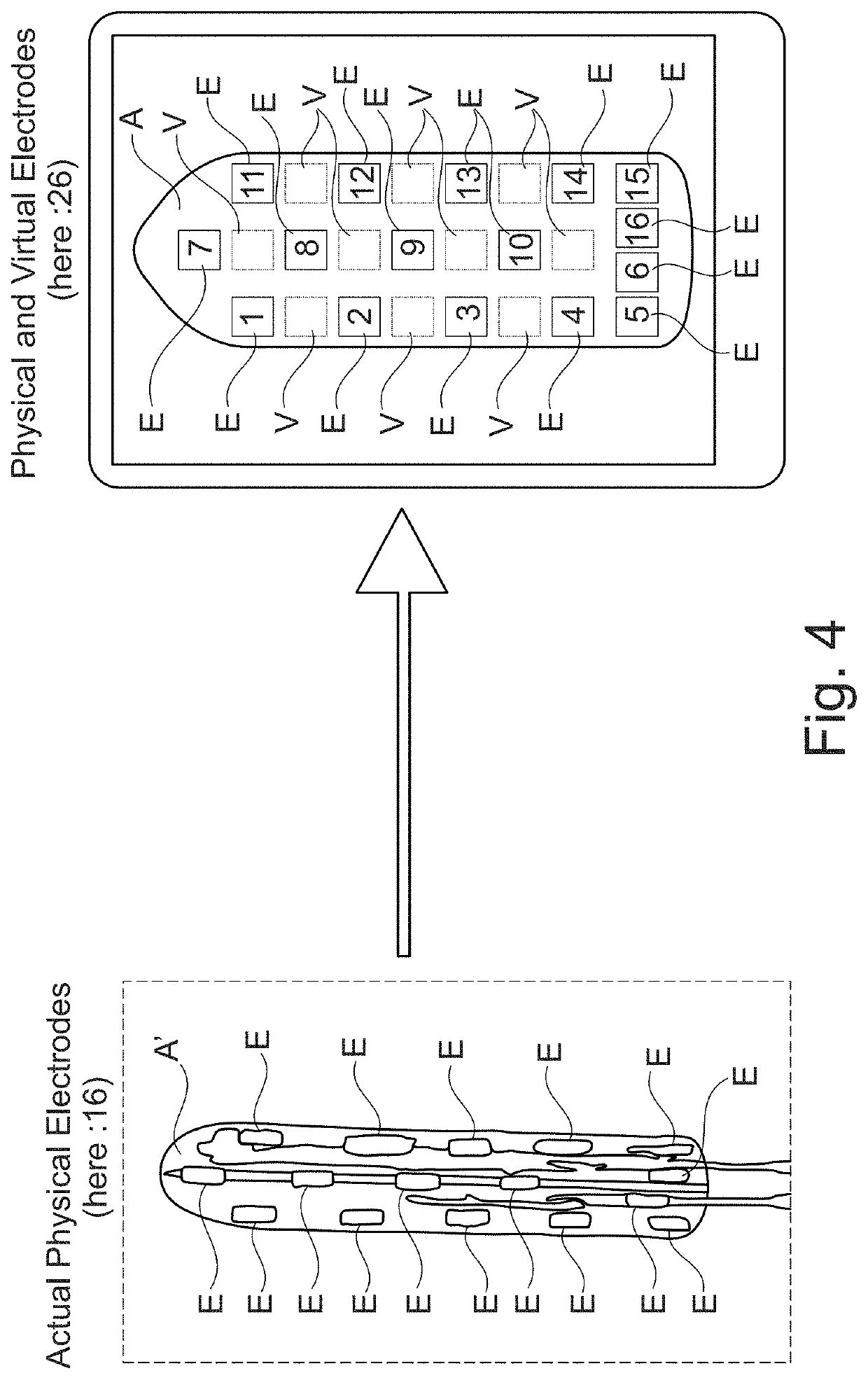 Planning and/or control system for a neuromodulation system