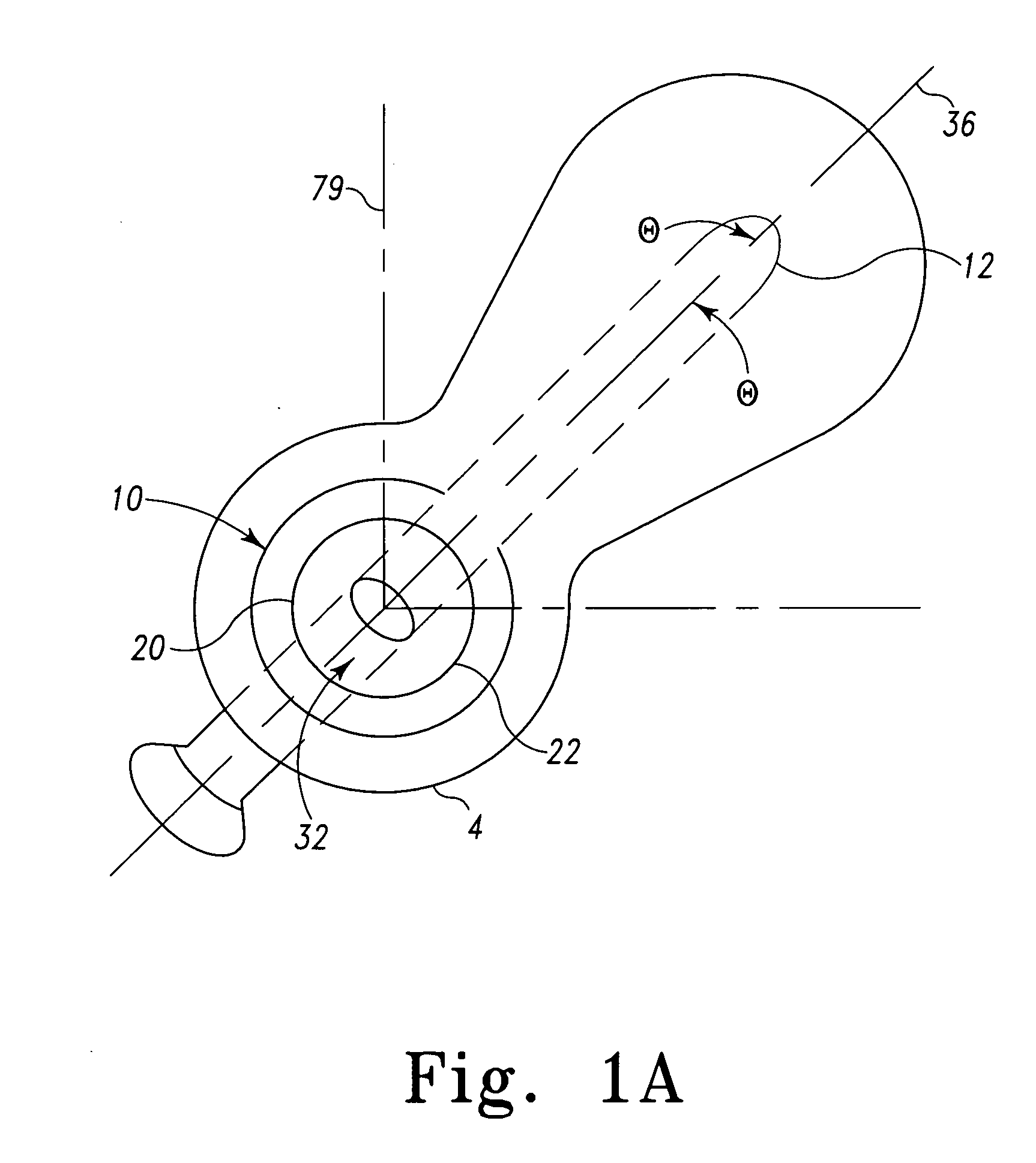 Variable angle intramedullary nail