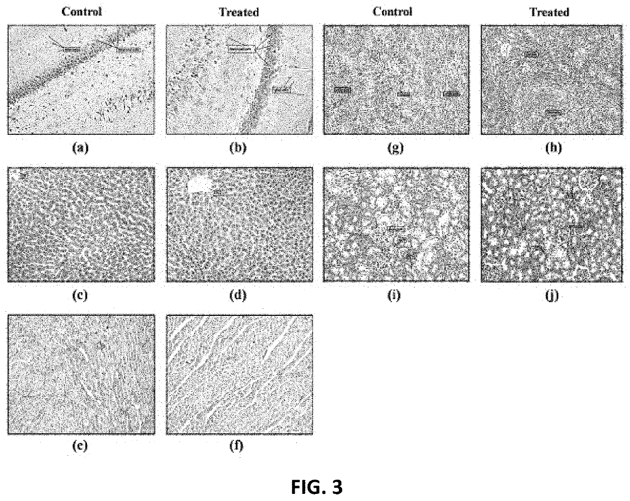 Composition and method for treating dyspepsia