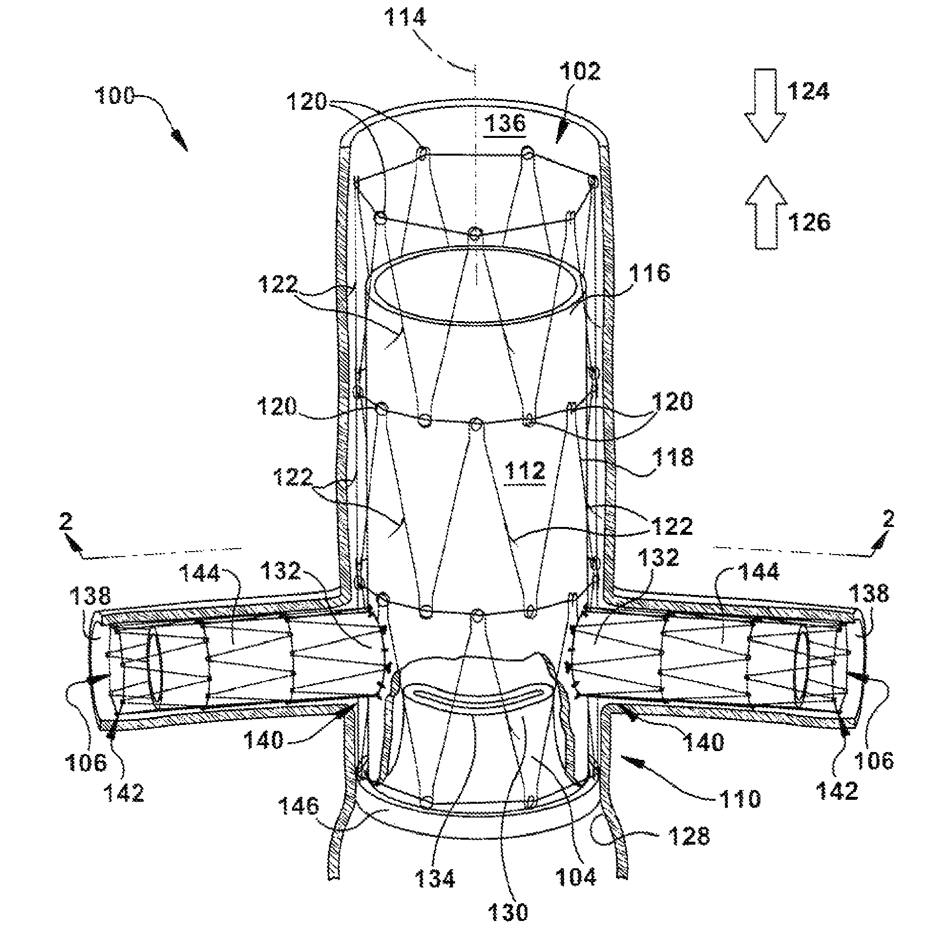 Apparatus for repairing the function of a native aortic valve