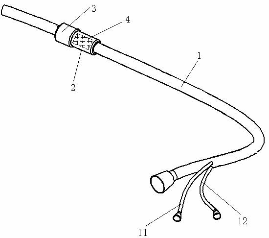 Esophagus-stomach anastomotic fistula occluder and application thereof