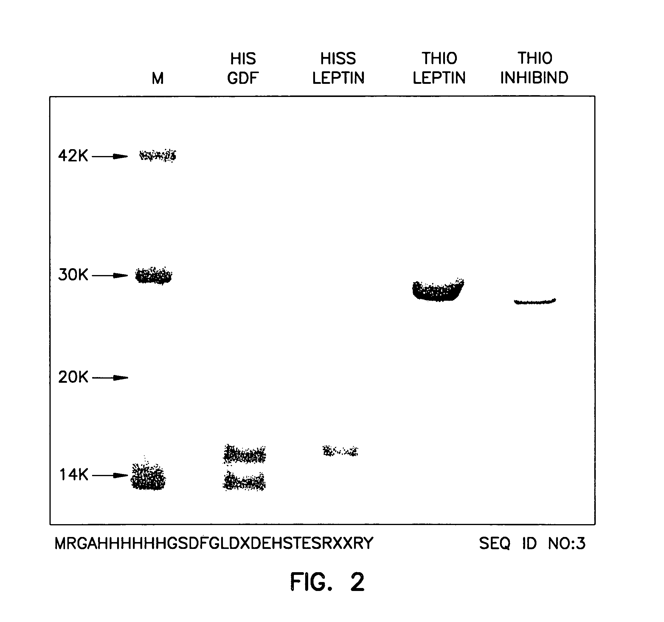 Use of passive myostatin immunization