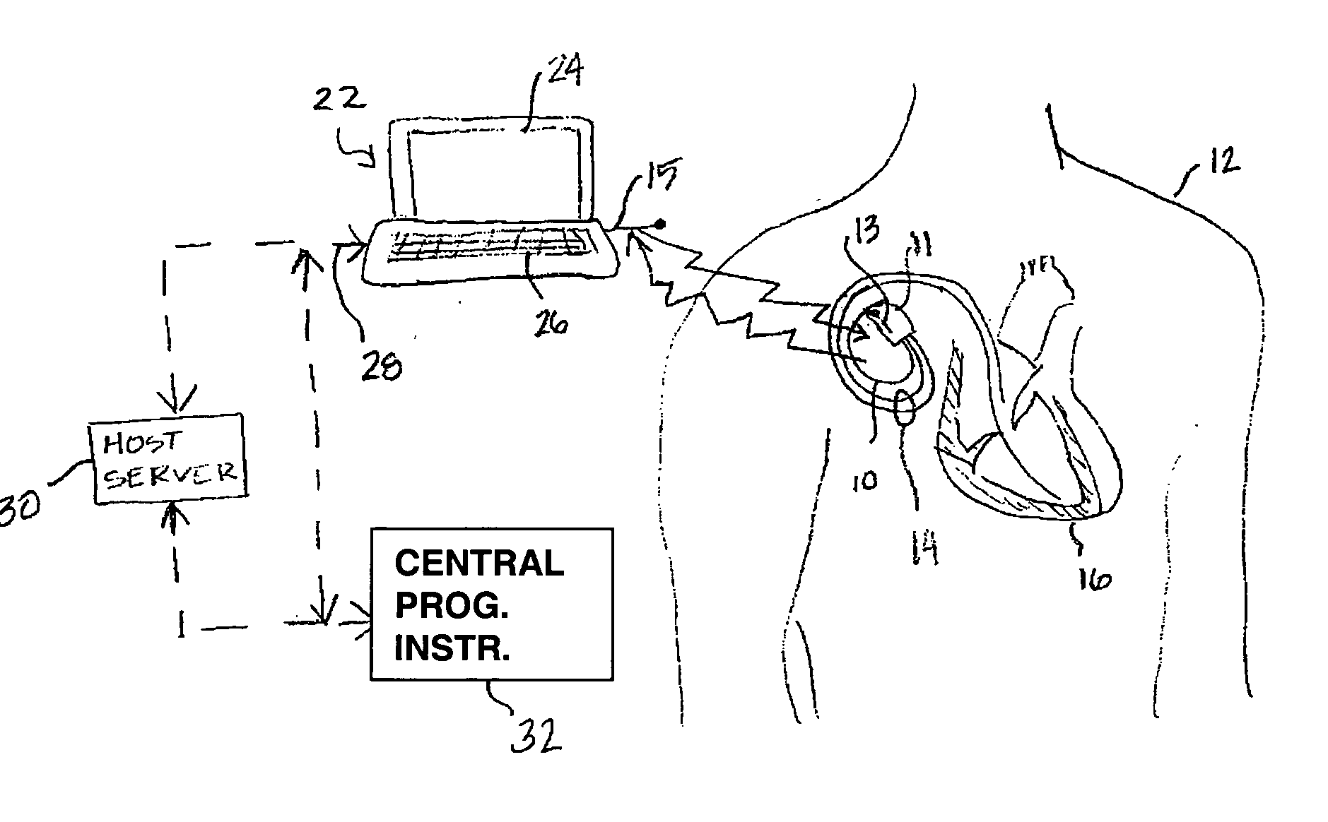 Conditional requirements for remote medical device programming