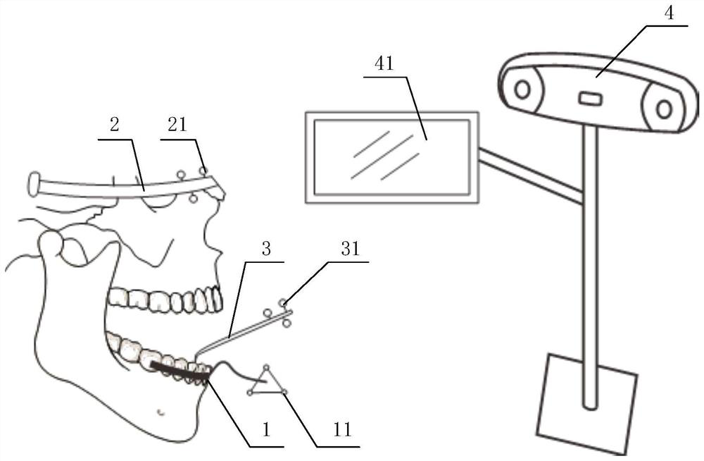 Mandibular movement capturing system, capturing method and simulation method