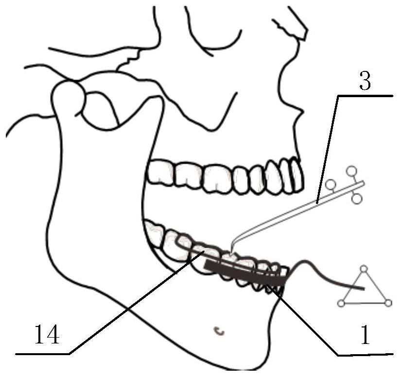 Mandibular movement capturing system, capturing method and simulation method