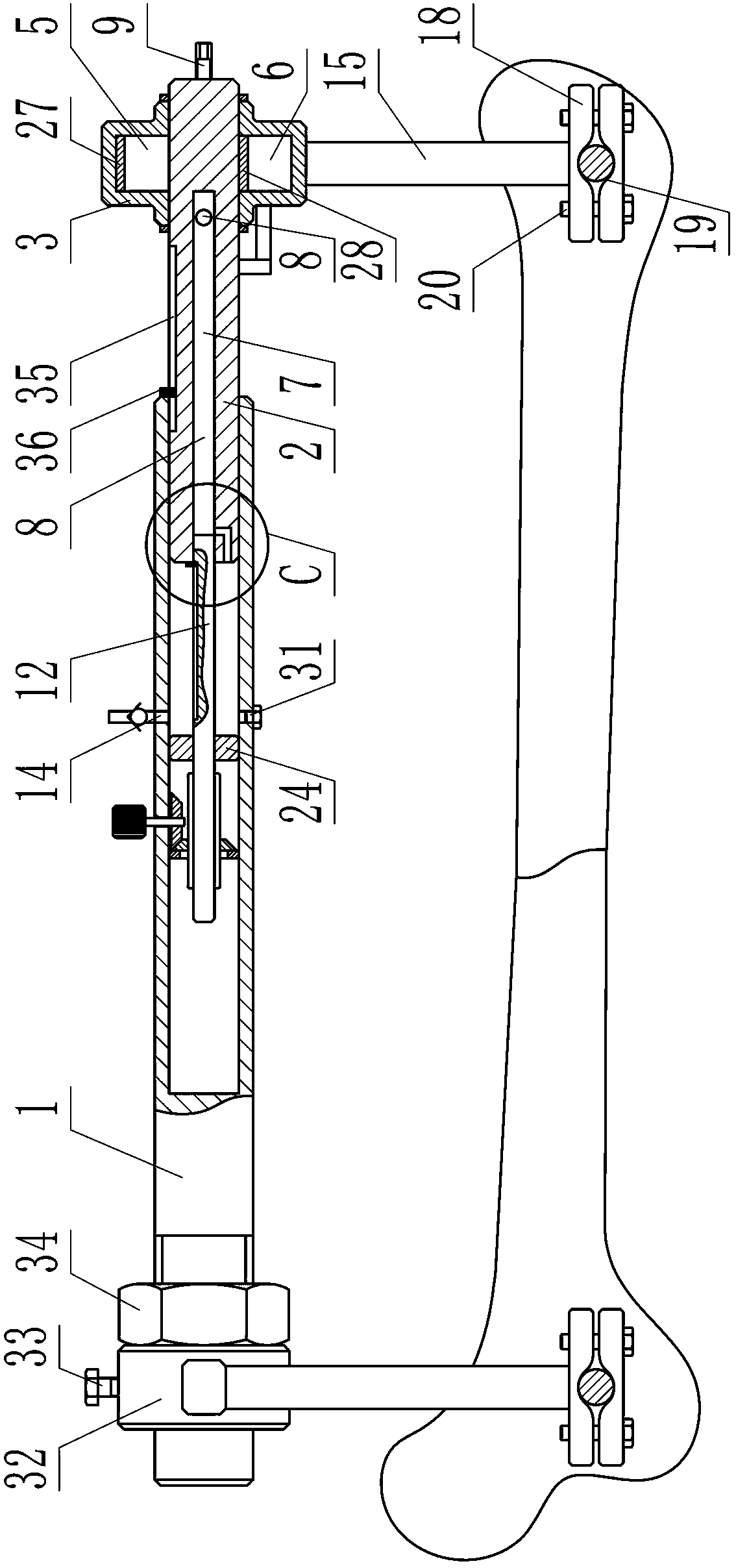 Bone fracture reduction device for four limb long bone diaphysis