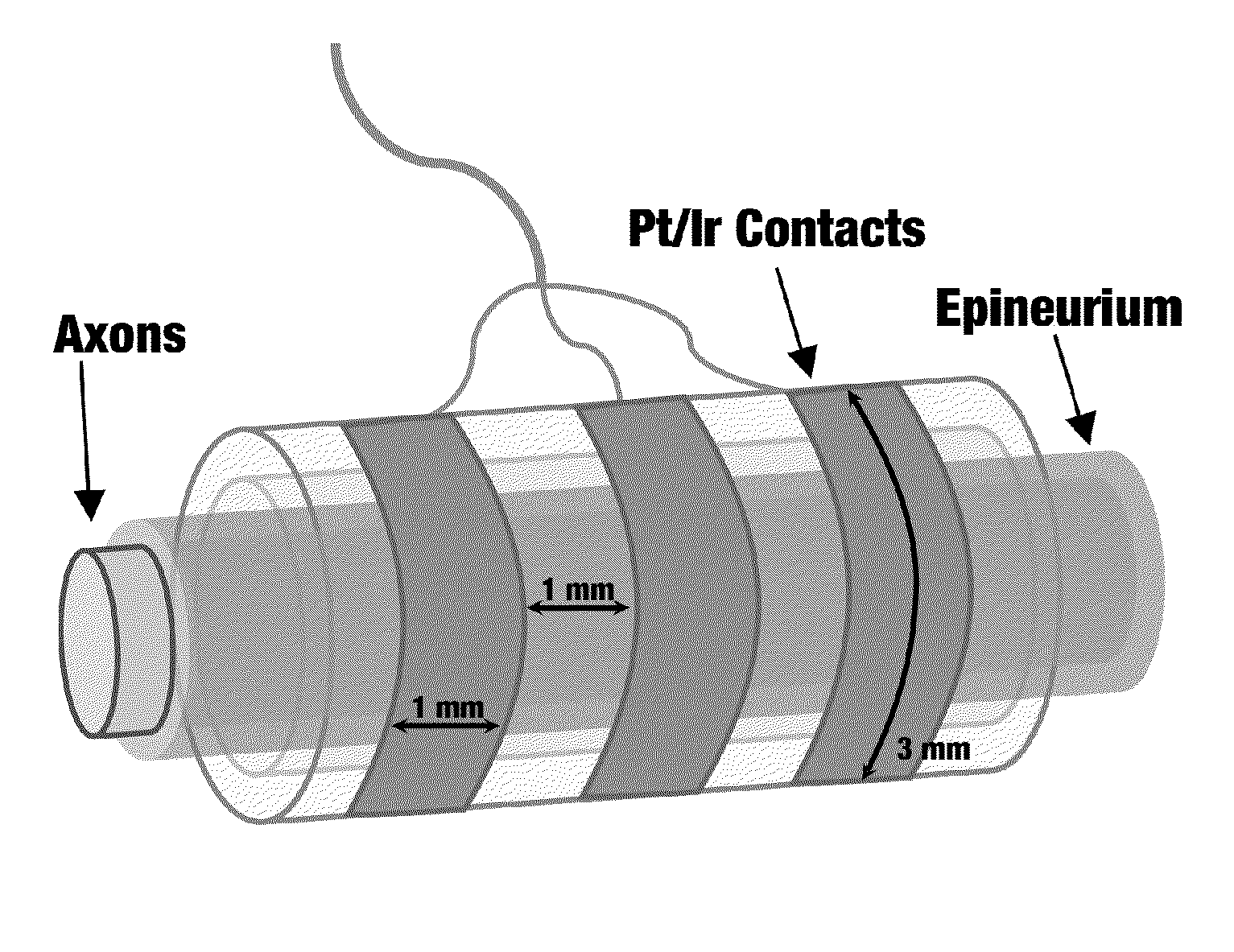 Selective block of nerve action potential conduction