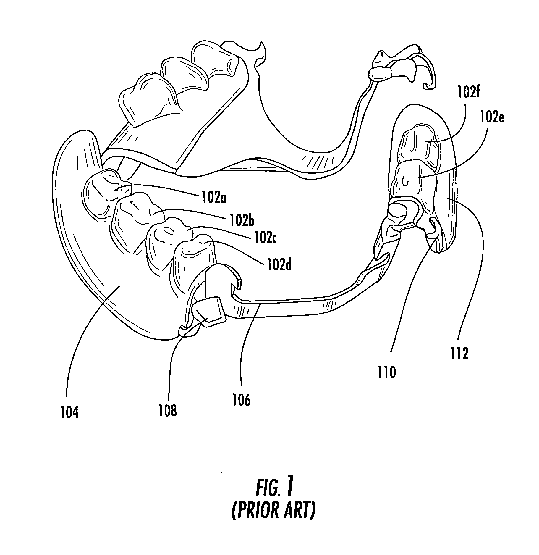 Denture device