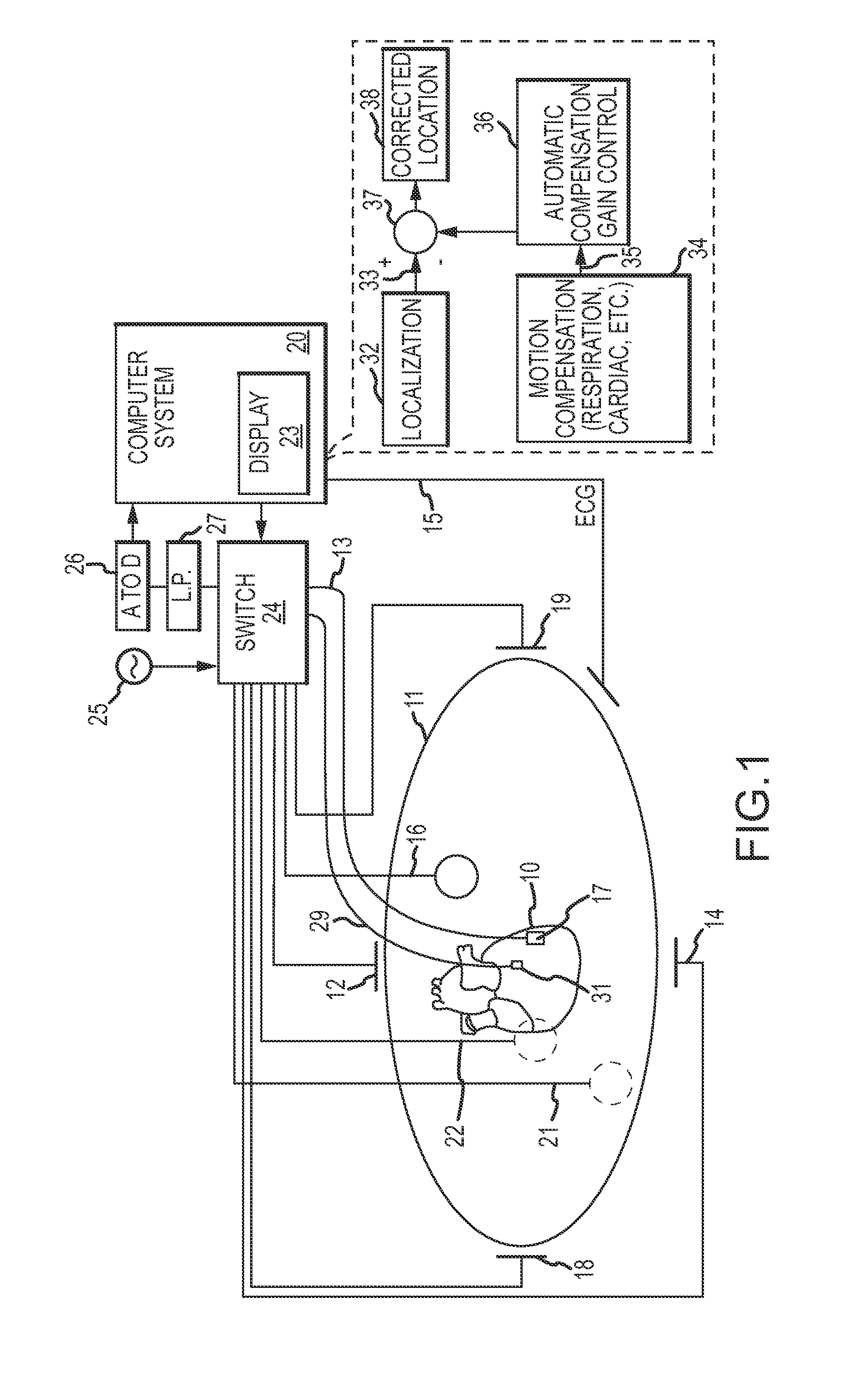 Dynamic adaptive respiration compensation with automatic gain control