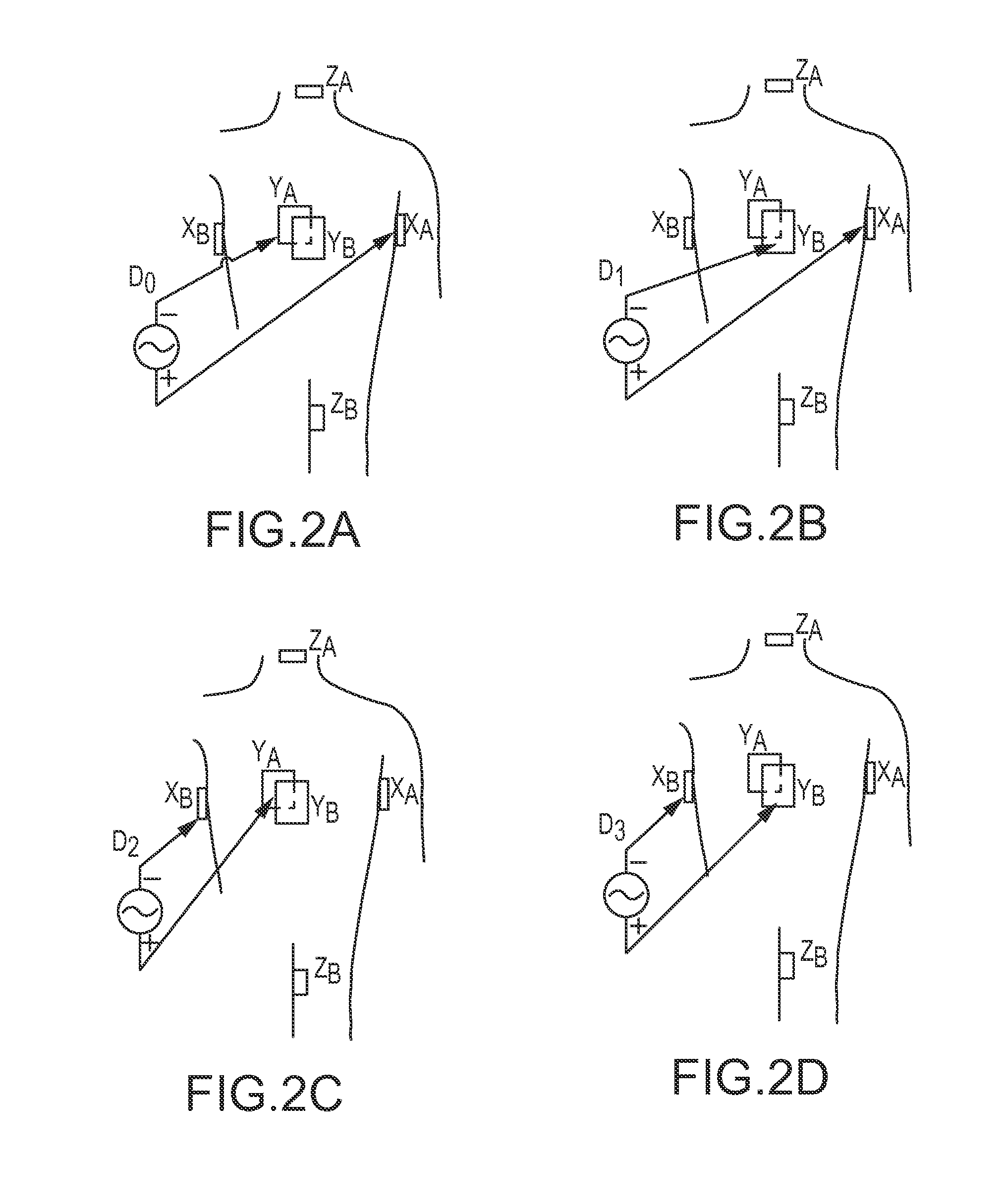 Dynamic adaptive respiration compensation with automatic gain control