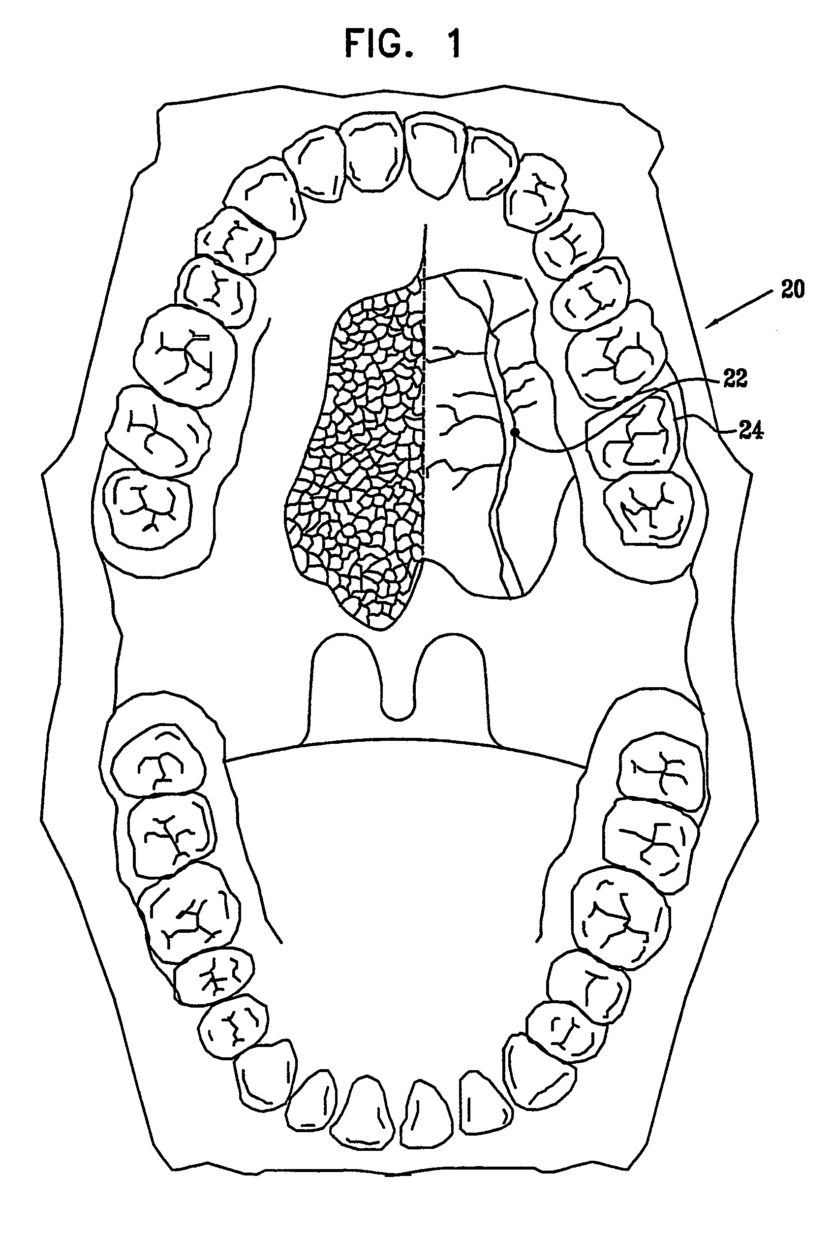 Surgical tools and techniques for stimulation