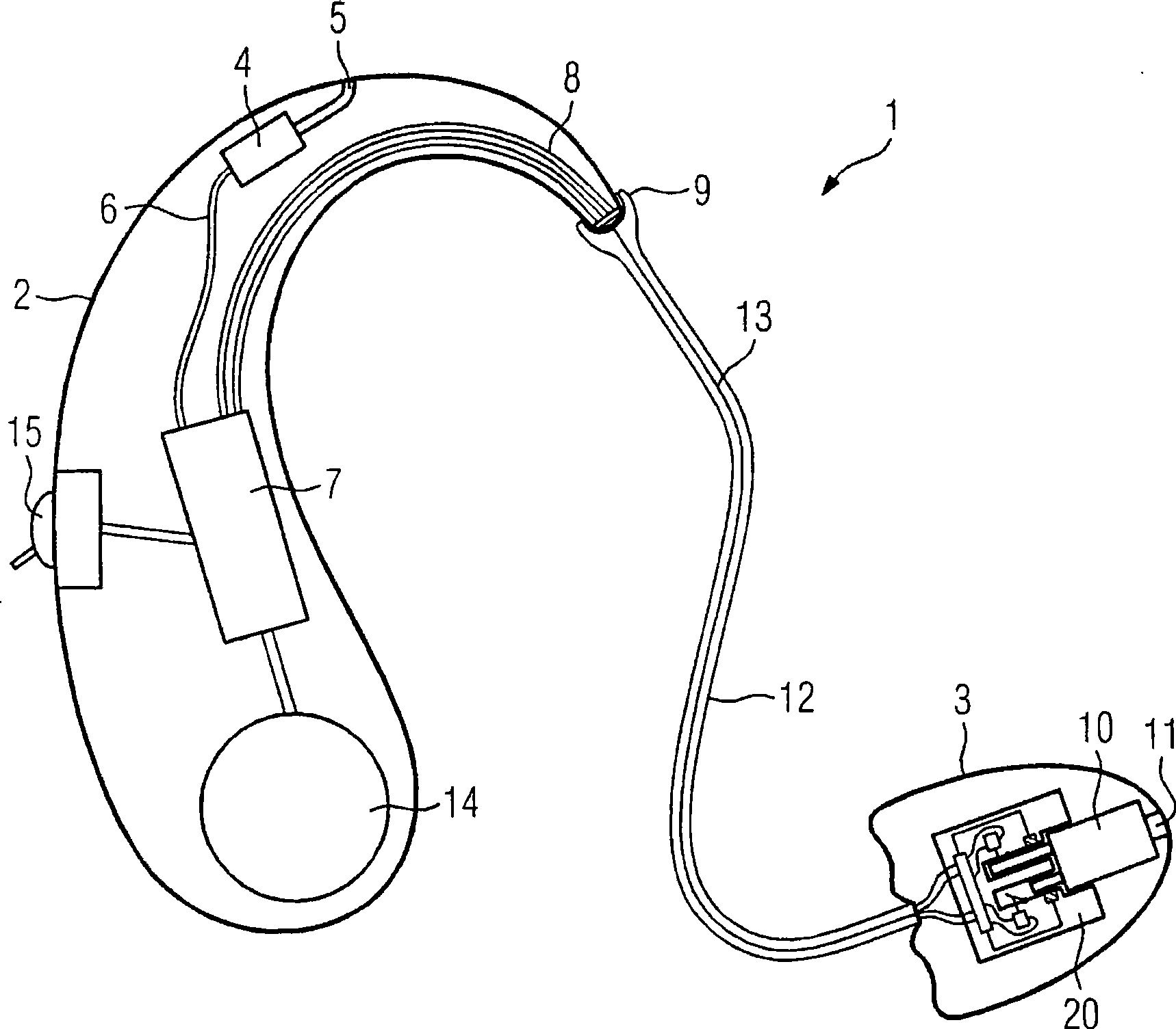 Automatic identification of receiver type in hearing aid devices