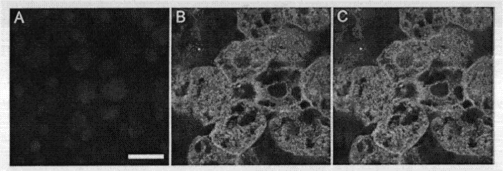 Selective medium of liver stem cells, method for selectively separating and amplifying liver stem cells, and medicinal composition for treating diabetes