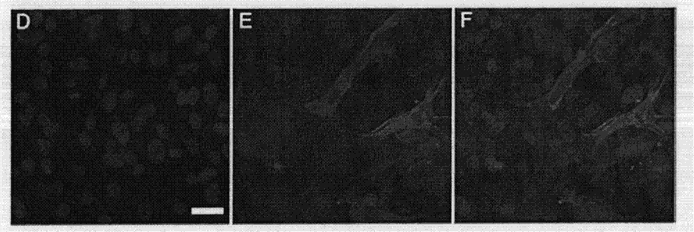 Selective medium of liver stem cells, method for selectively separating and amplifying liver stem cells, and medicinal composition for treating diabetes