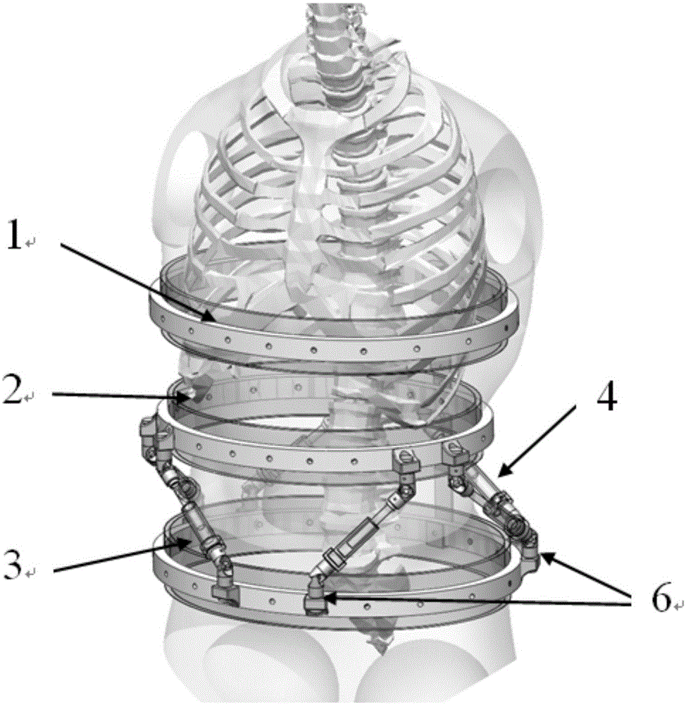 Robot used for spondylodynia rehabilitation treatment