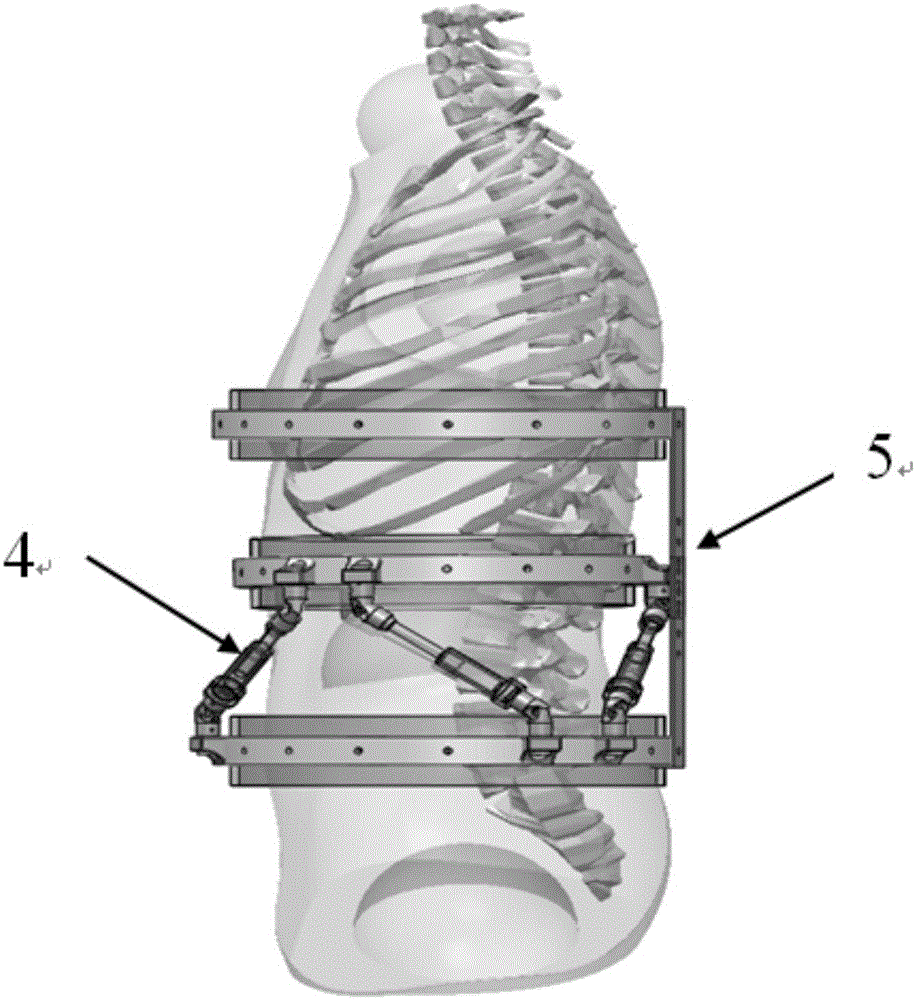 Robot used for spondylodynia rehabilitation treatment