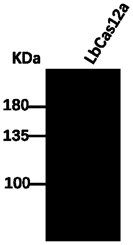 CRISPR-Cas12a detection primer group for francisella tularensis and application thereof