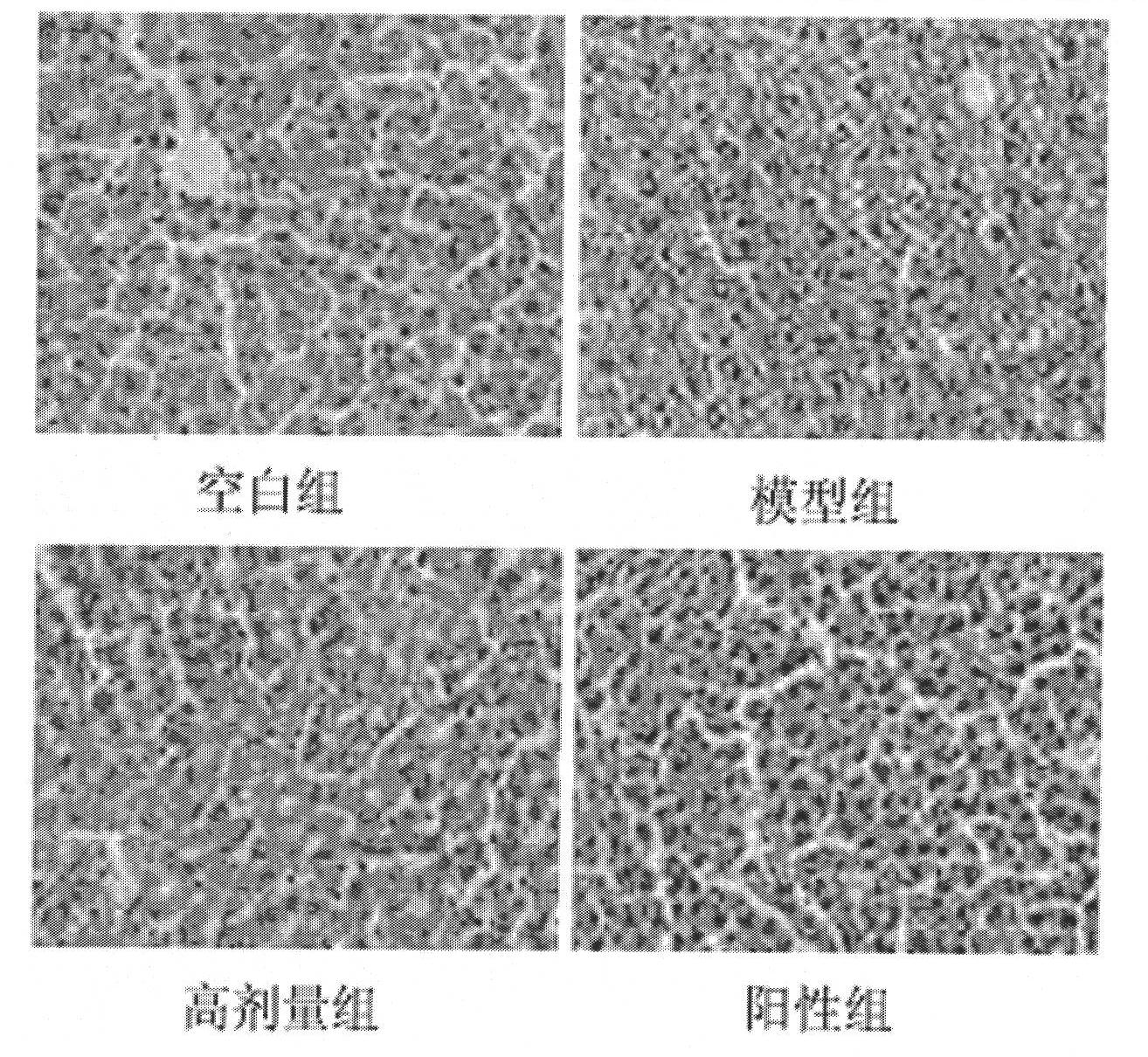 Application of dioscin in preparation of liver-protecting pharmaceutical preparation