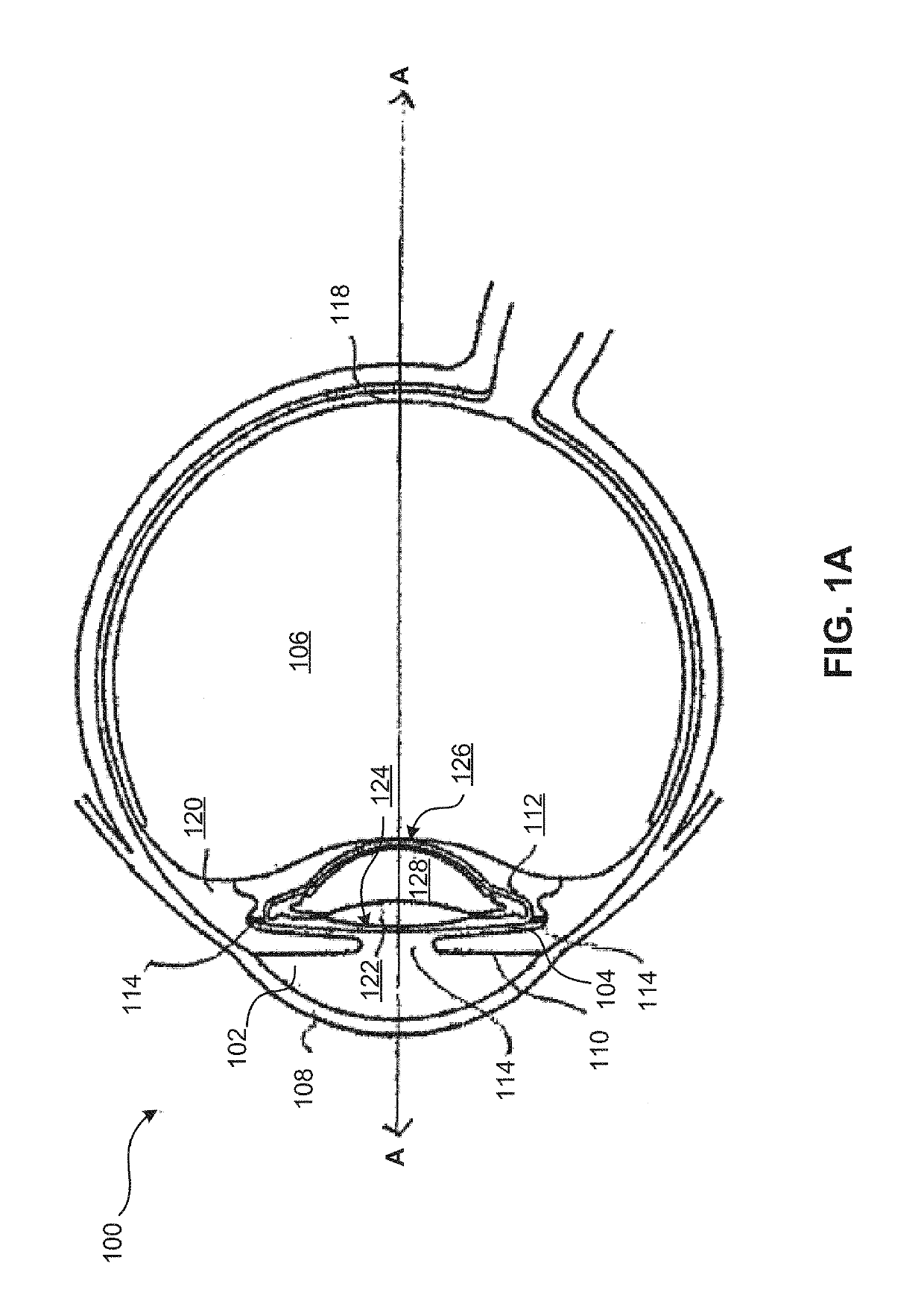 Lens oil having a narrow molecular weight distribution for intraocular lens devices