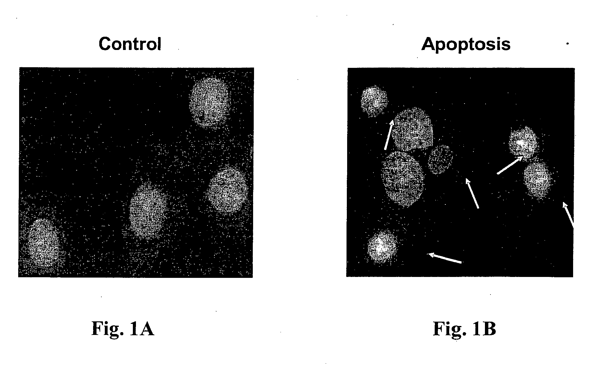 Methods for treatment of cardiovascular disorders and diseases