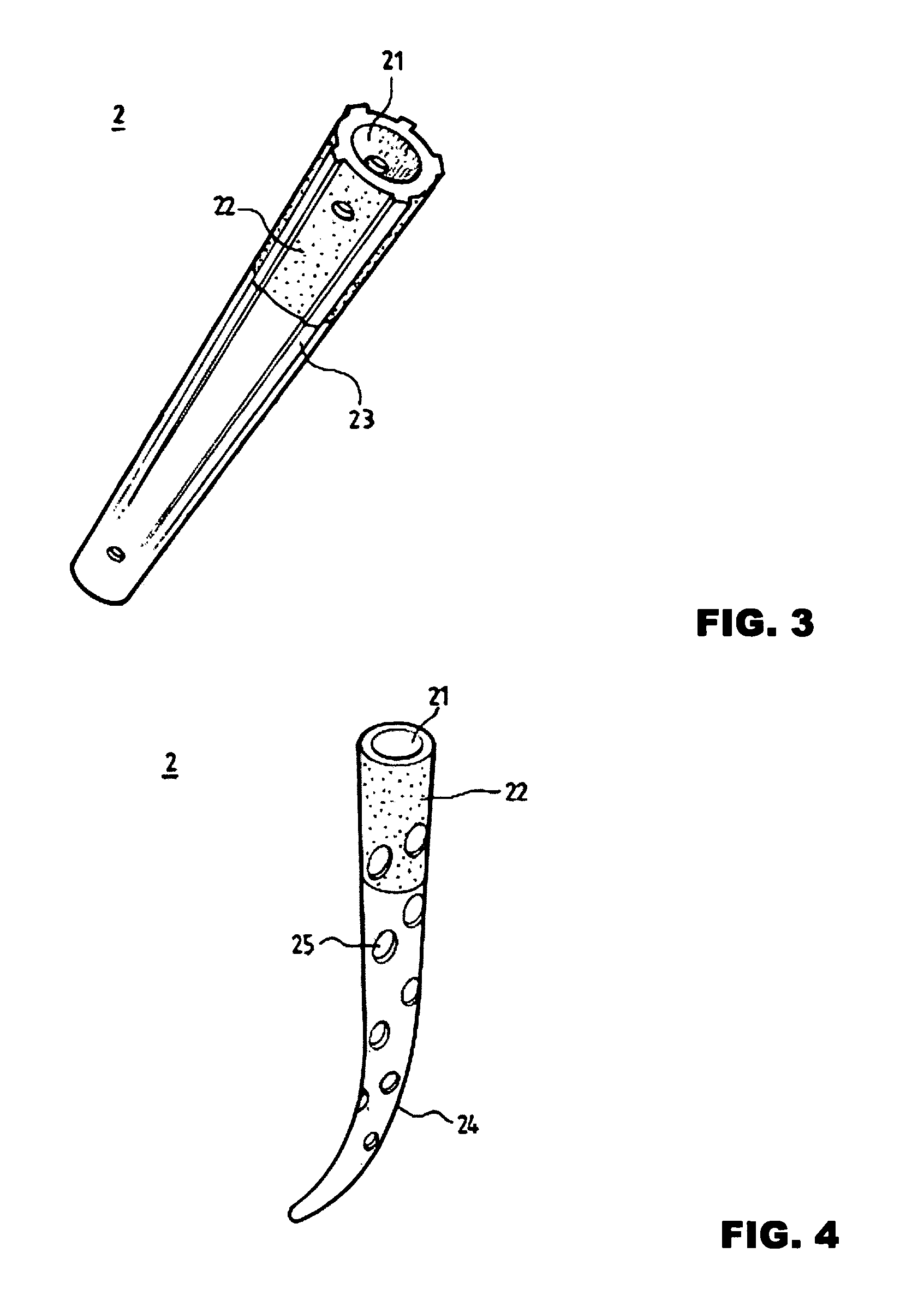 Femoral head surface replacement system