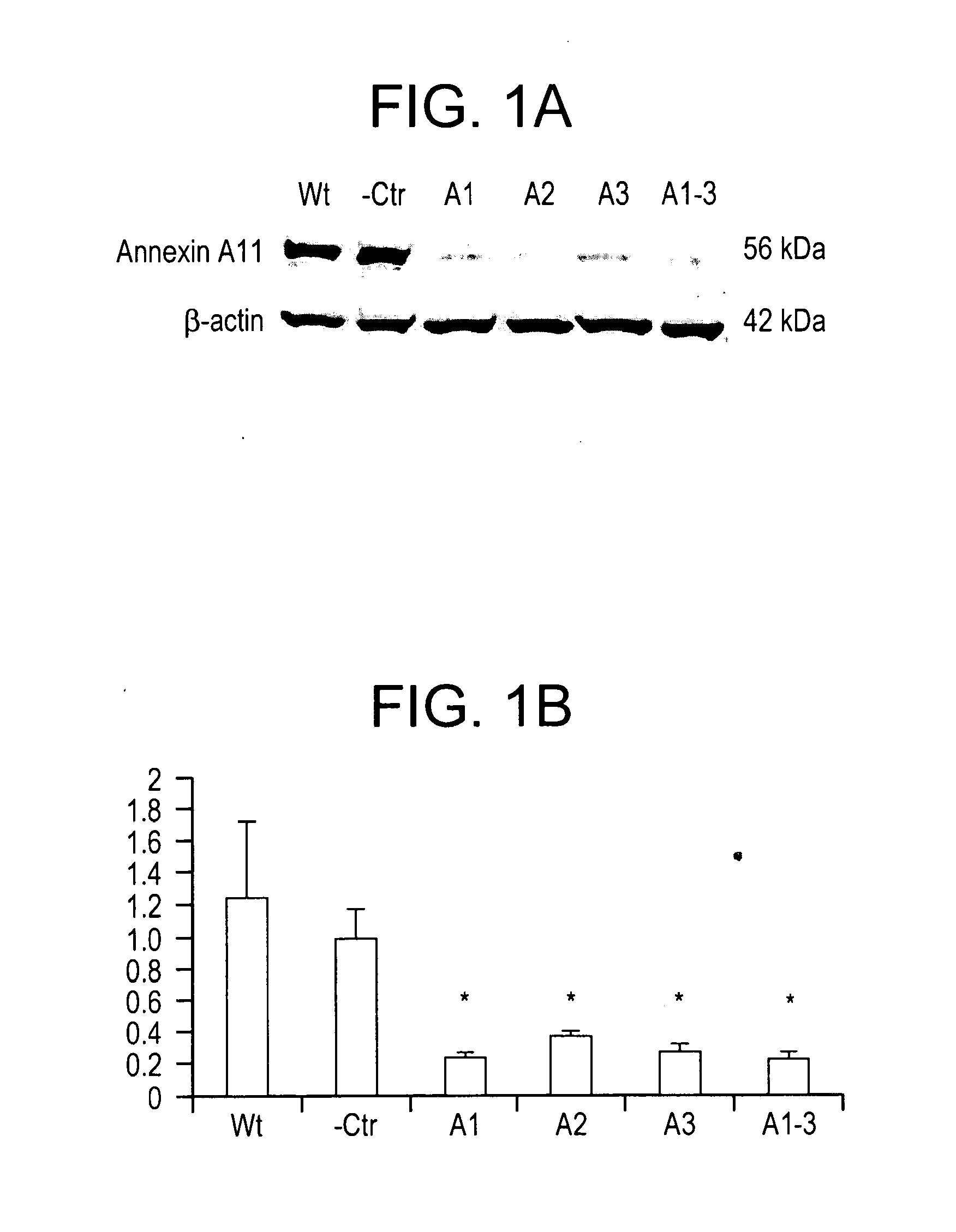 Annexin a11 and associated genes as biomarkers for cancer