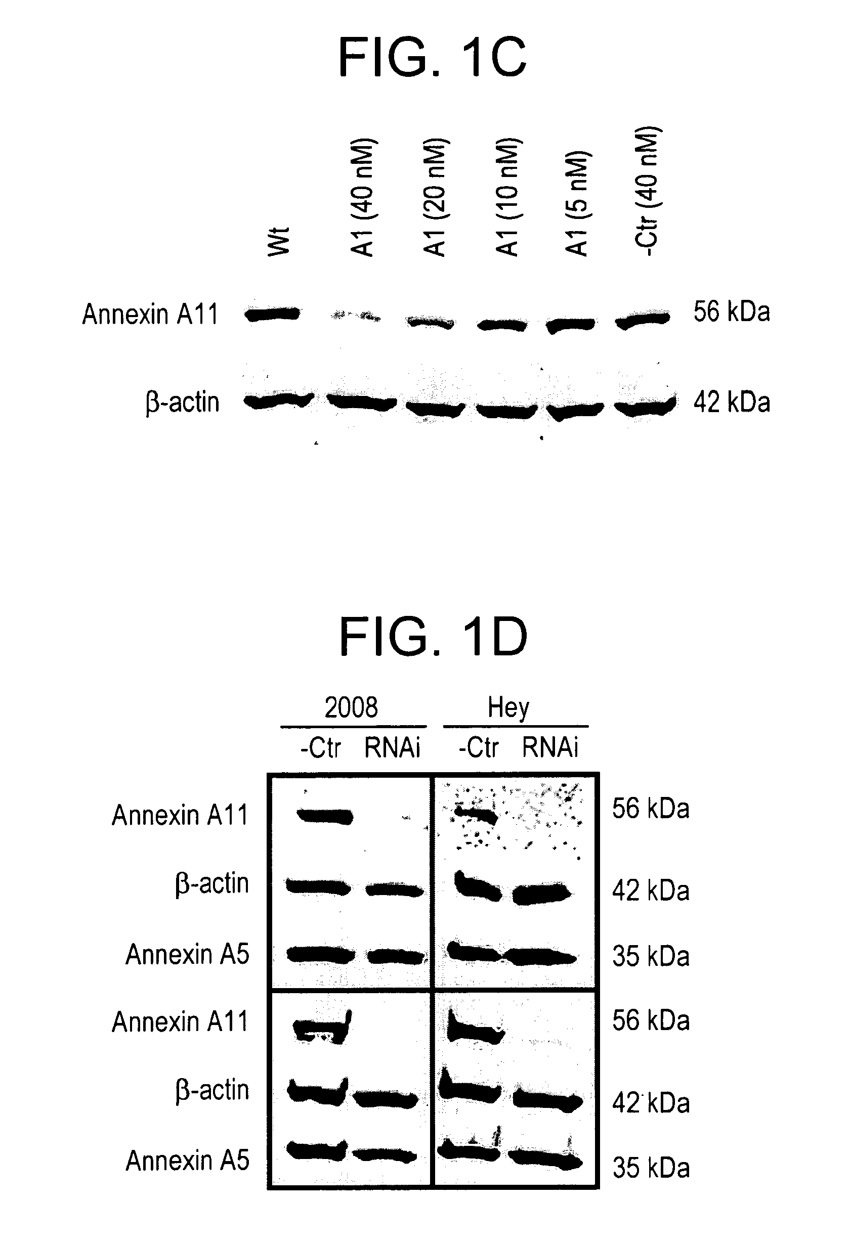 Annexin a11 and associated genes as biomarkers for cancer