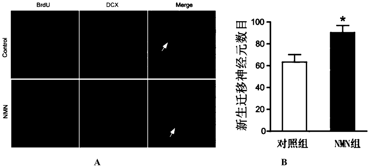 Application of nicotinamide mononucleotide in the preparation of drugs for promoting nerve regeneration after cerebral ischemia