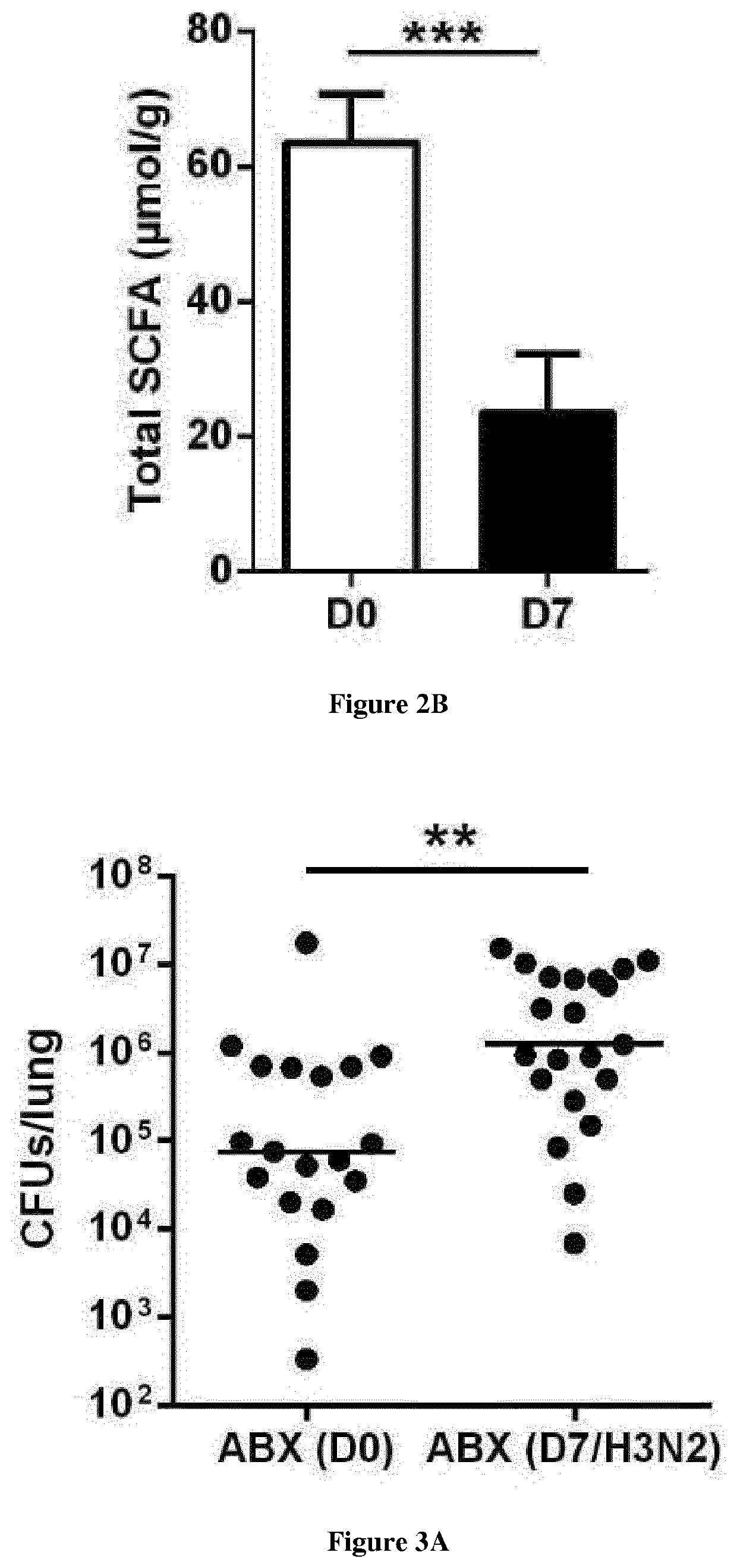 Use of short-chain fatty acids for the treatment of bacterial superinfections post-influenza