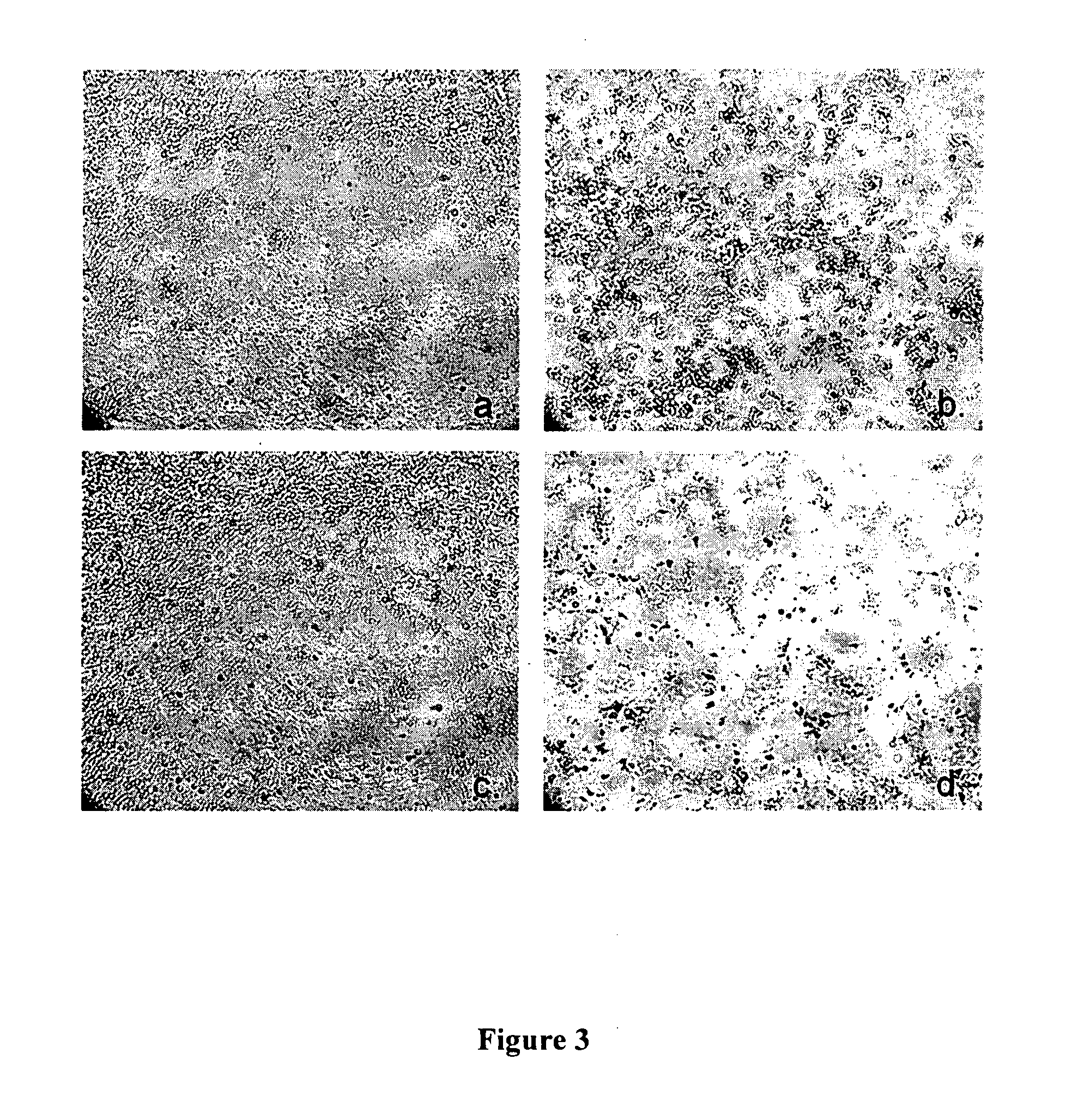 Clostridial toxin netb