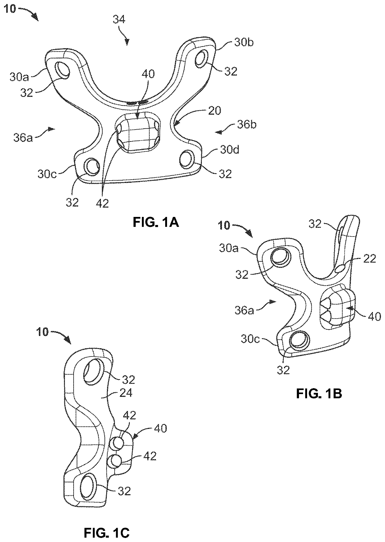 Medial Trochanteric Plate Fixation