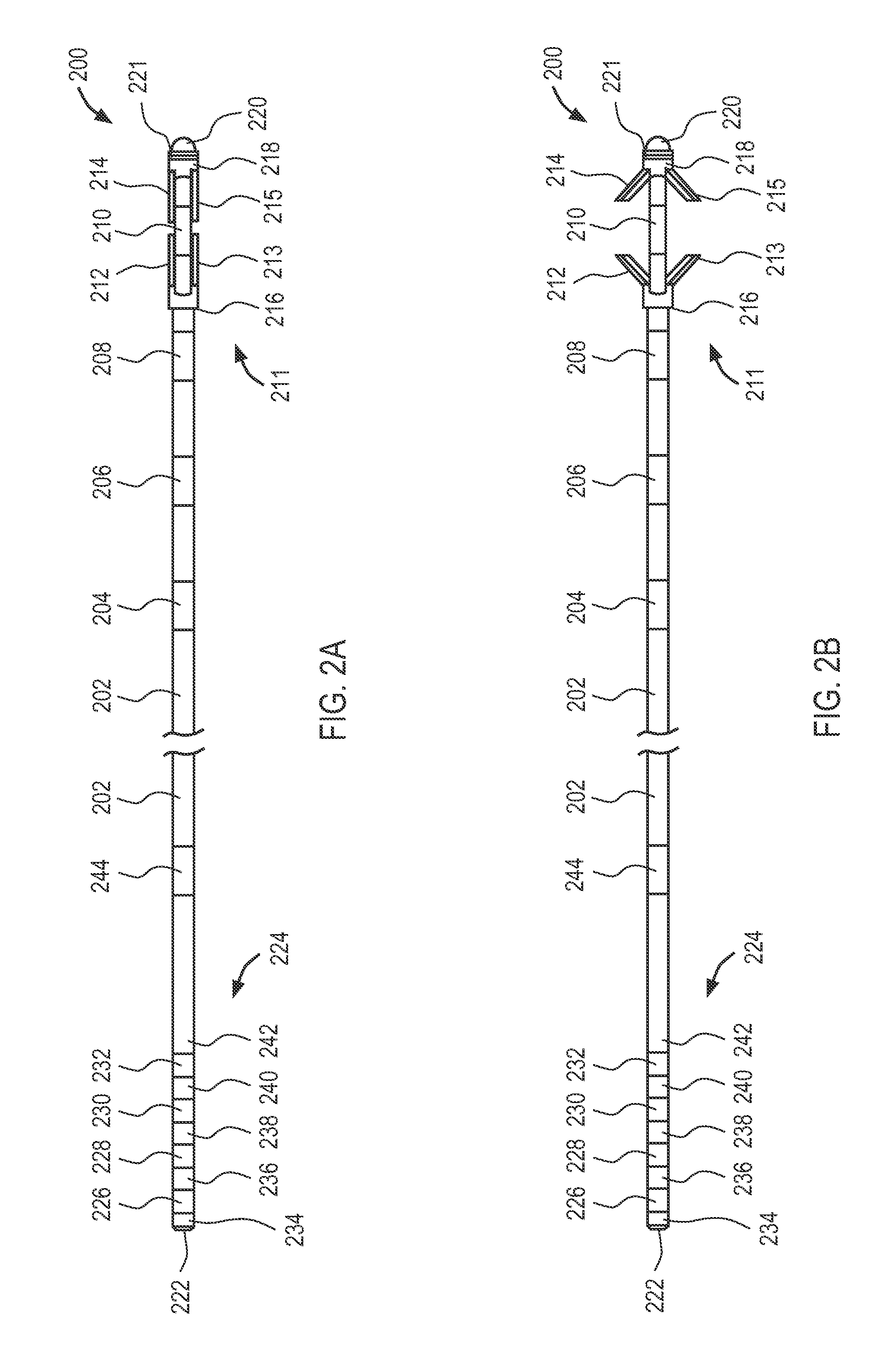 Systems and methods for implanting electrode leads for use with implantable neuromuscular electrical stimulator