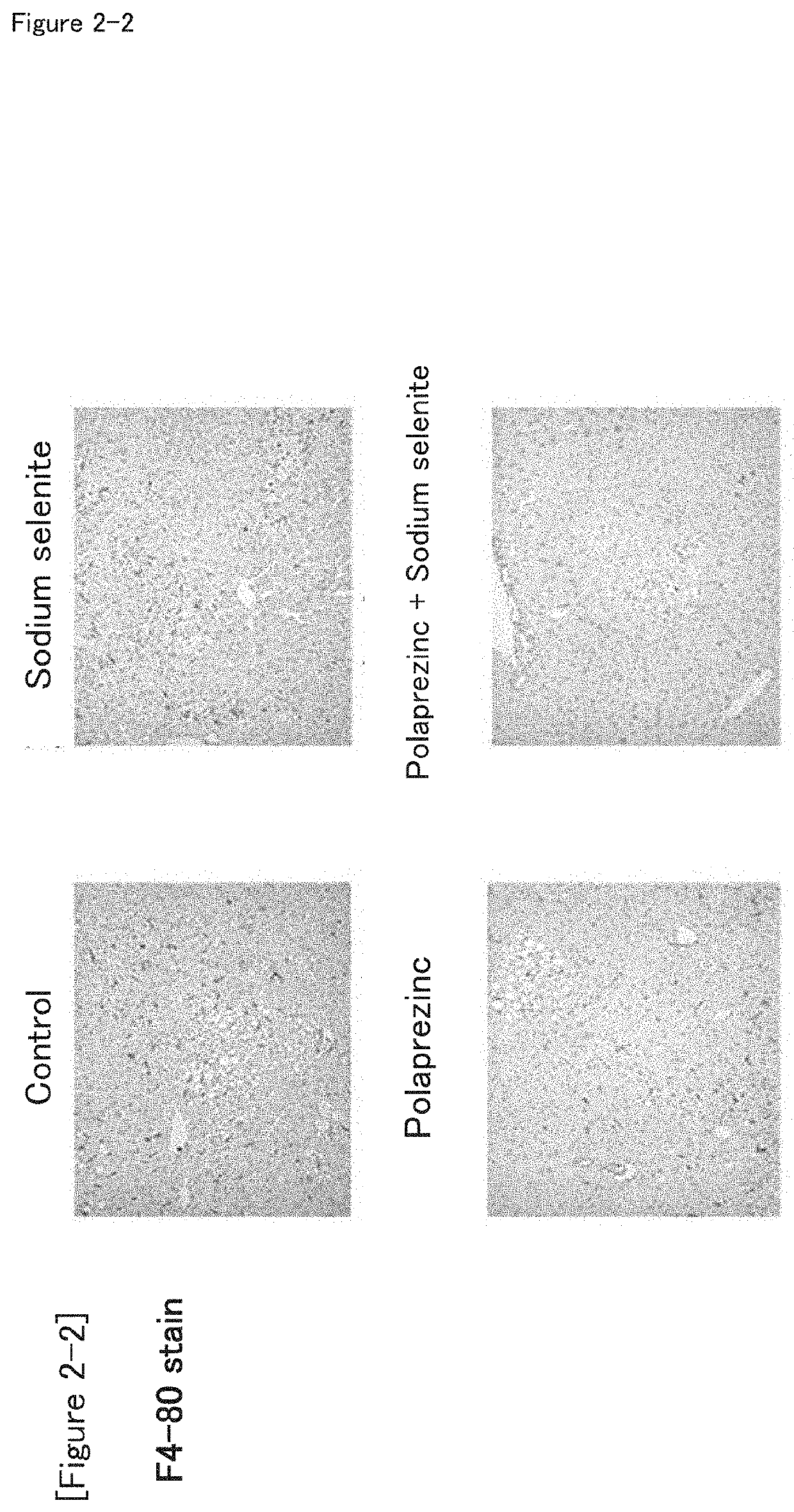 Combination drug suitable for treatment and prevention of non-alcoholic fatty liver disease (NAFLD) and/or non-alcoholic steatohepatitis (NASH), and/or hepatic fatty degeneration