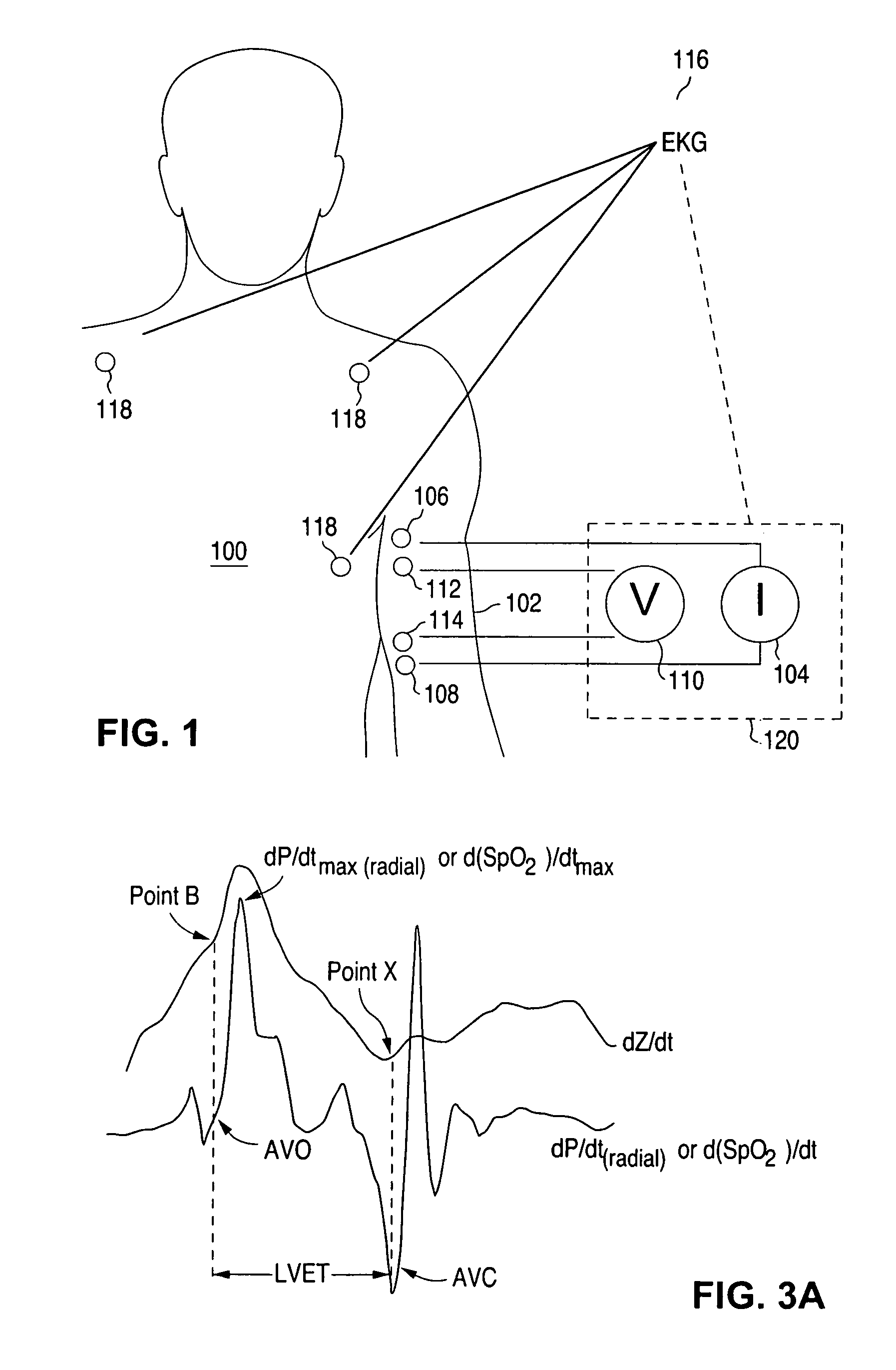 Apparatus for determination of stroke volume using the brachial artery