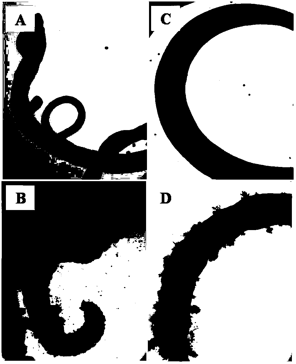 Application of compound in preparation of drug used for resisting Schistosomiasis japonicum