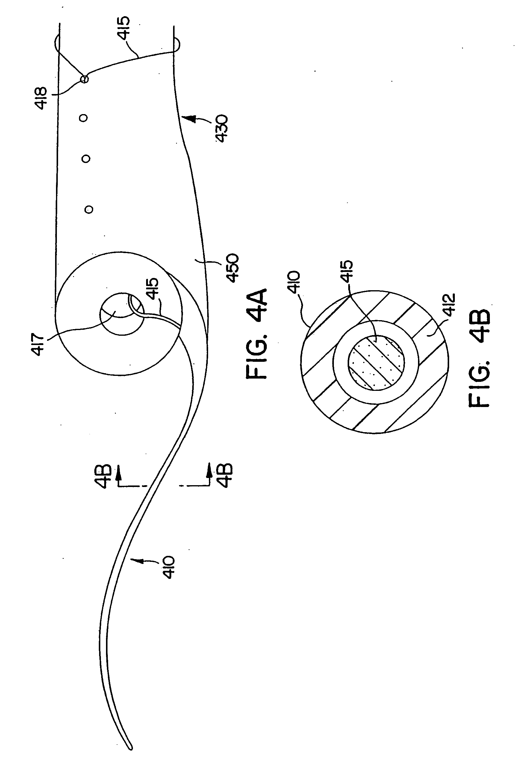 Ureteral stent for improved patient comfort