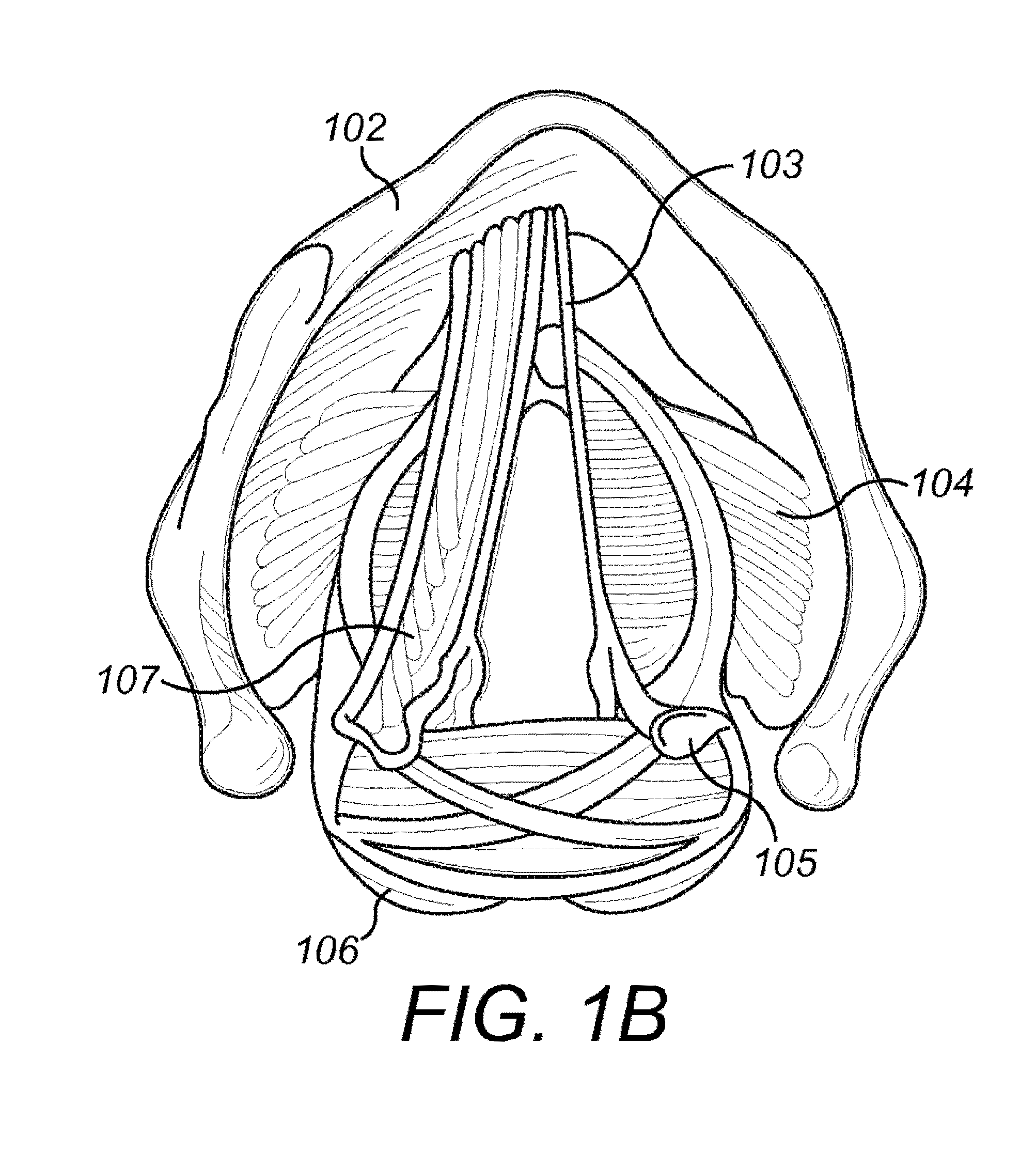 Respiration Sensors For Recording Of Triggered Respiratory Signals In Neurostimulators