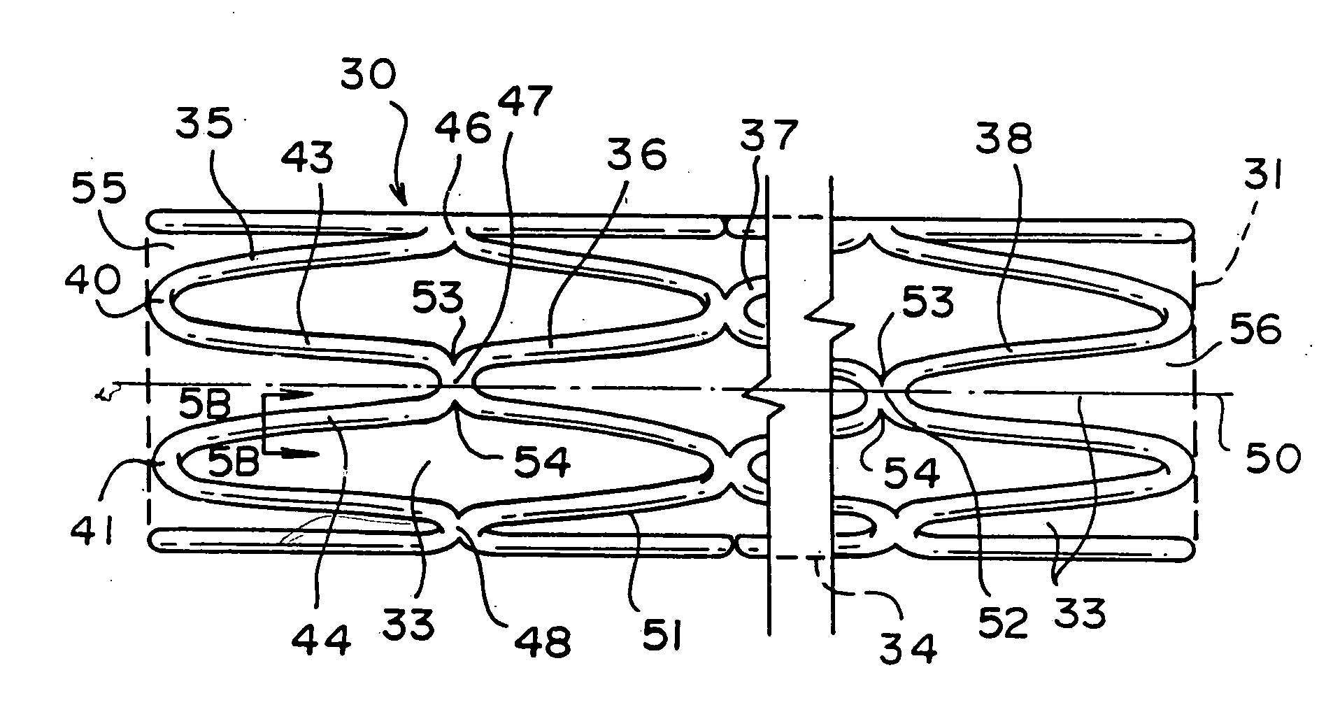 Tubular stent with oval struts